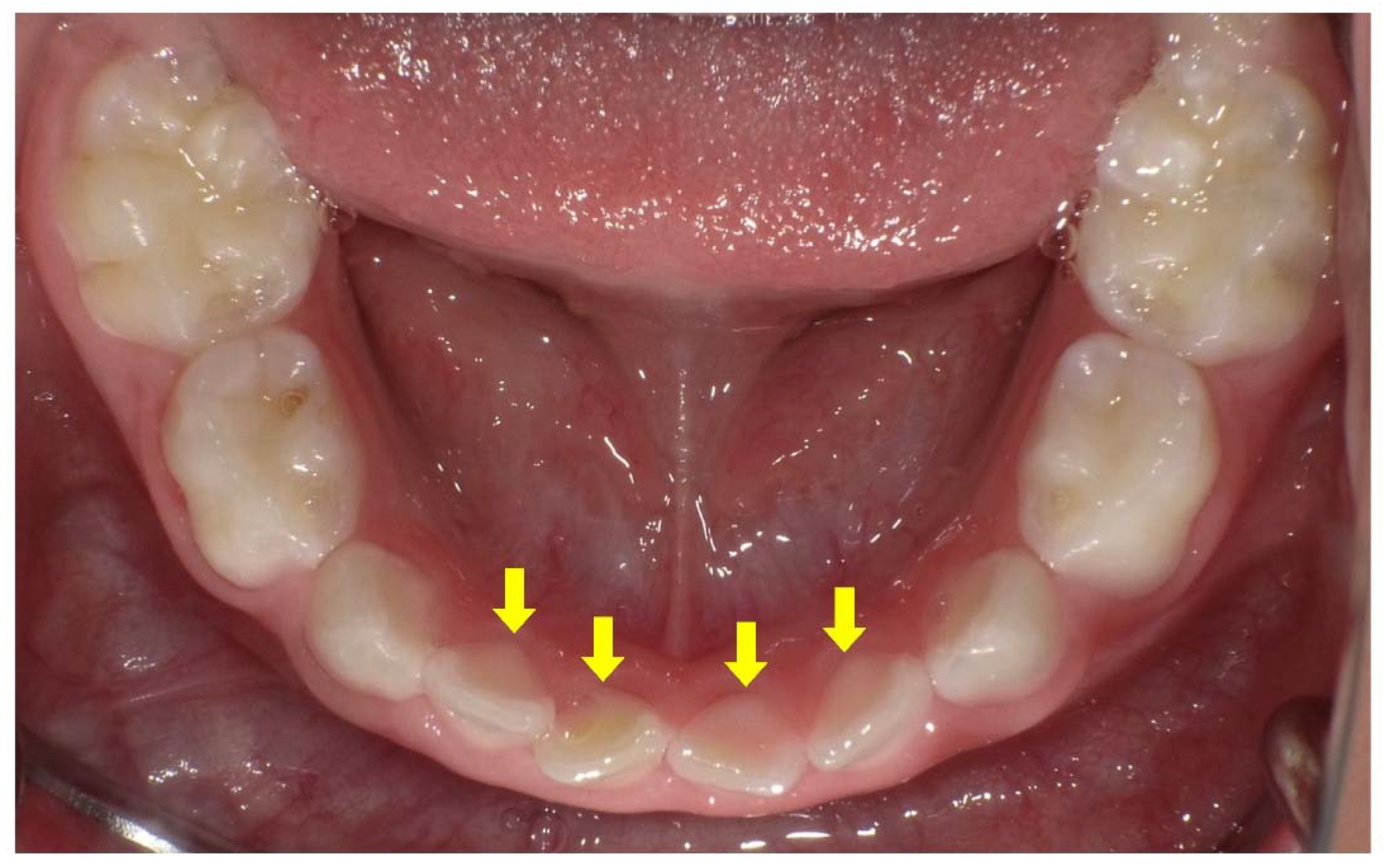 Endocrines 03 00056 g005