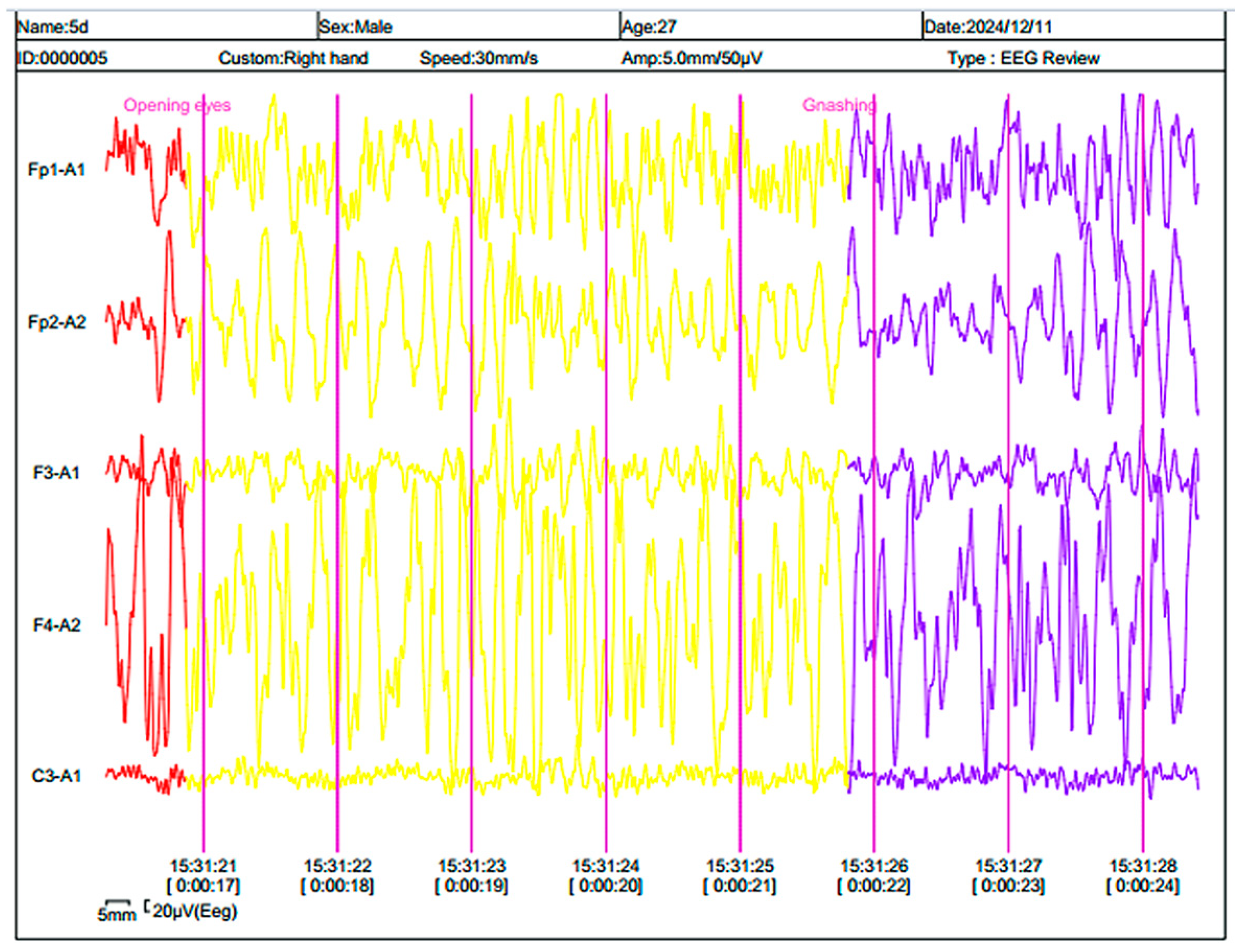 Engproc 104 00013 g003