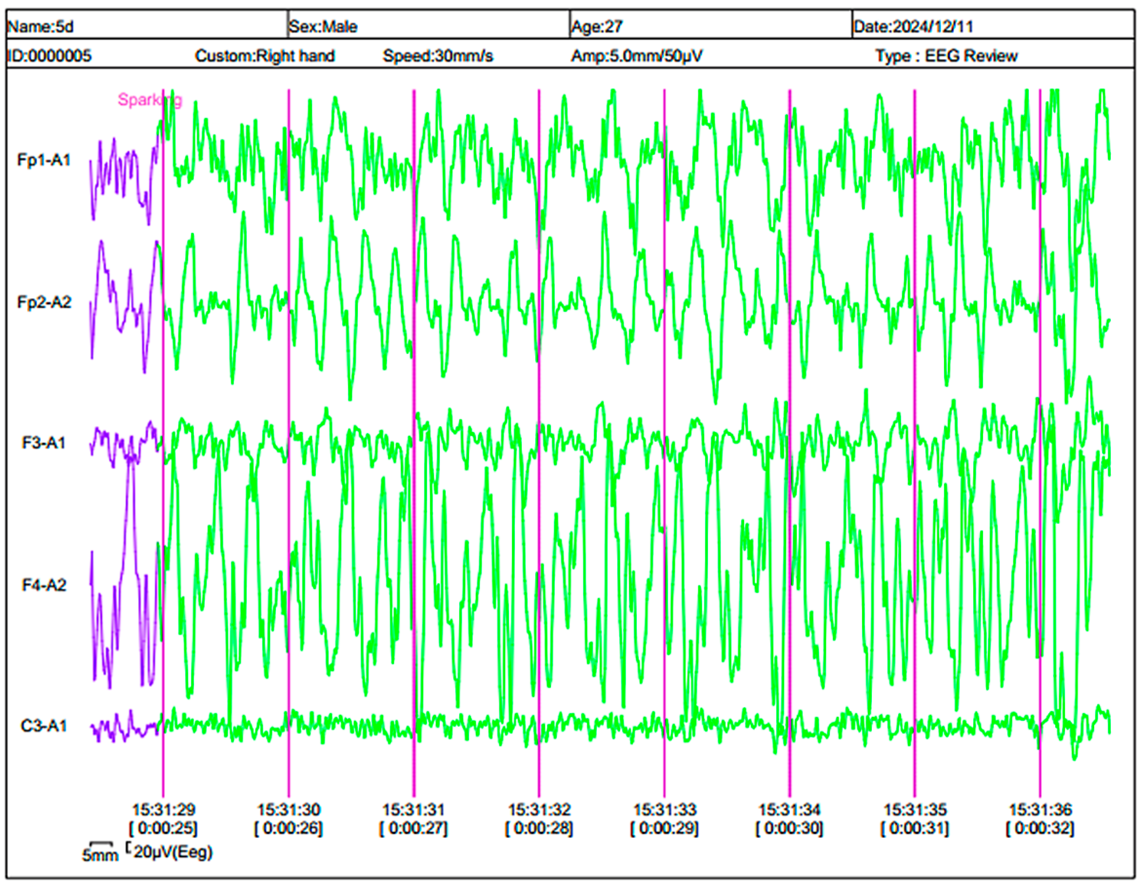 Engproc 104 00013 g004