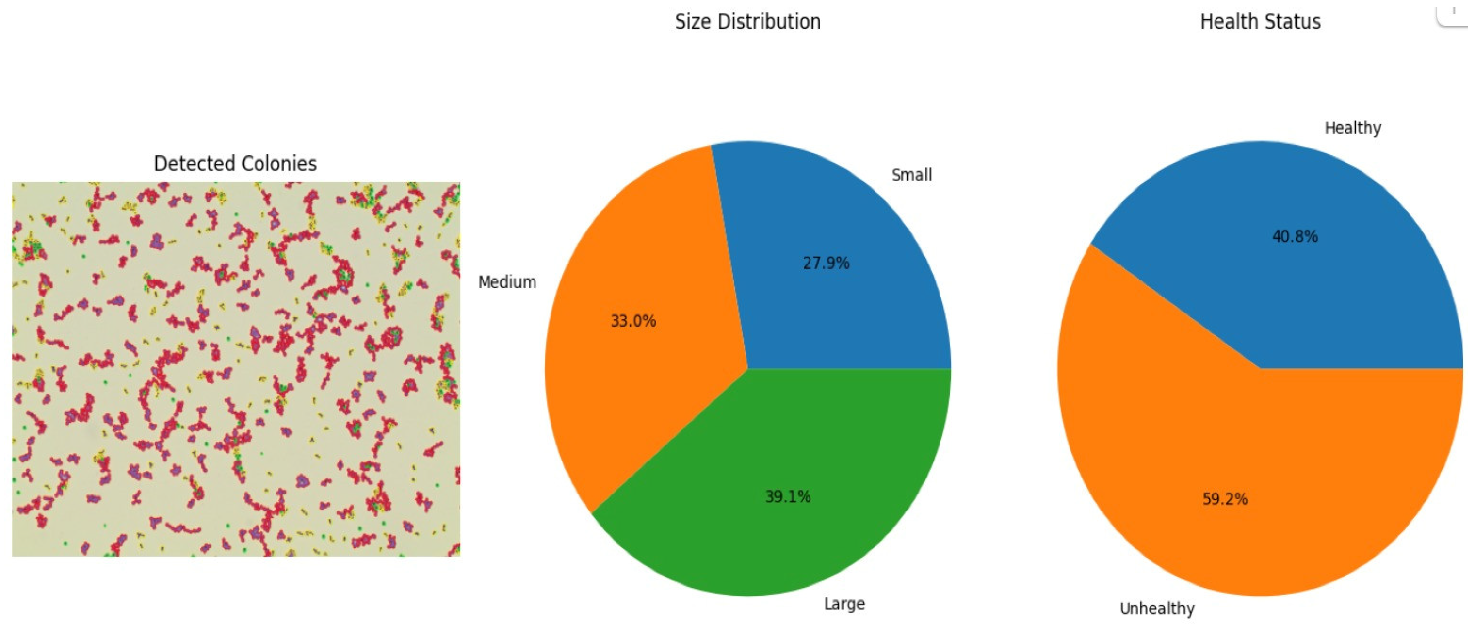 Real-Time Bacterial Colony Count Detection and Classification Using ...