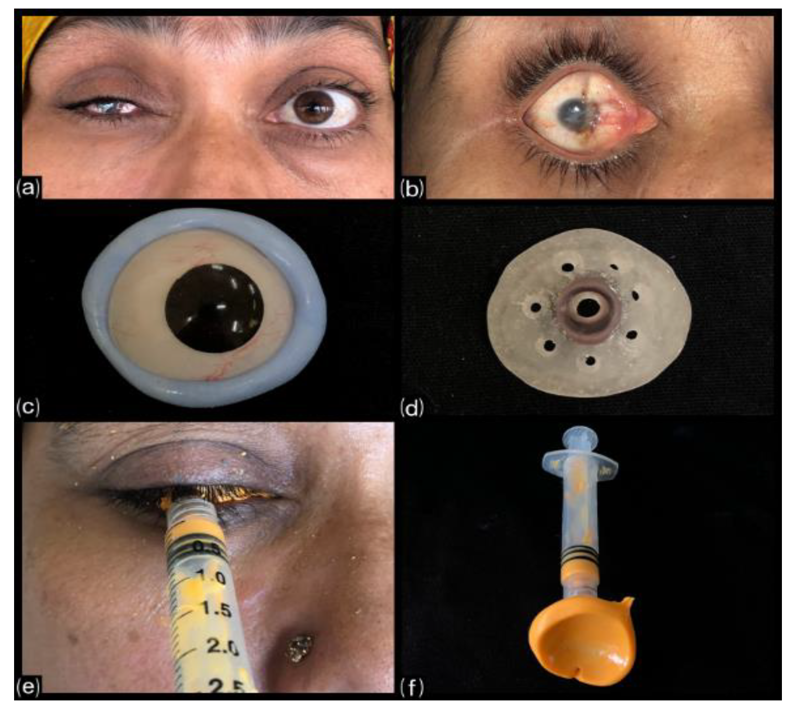 Engproc 56 00150 g001