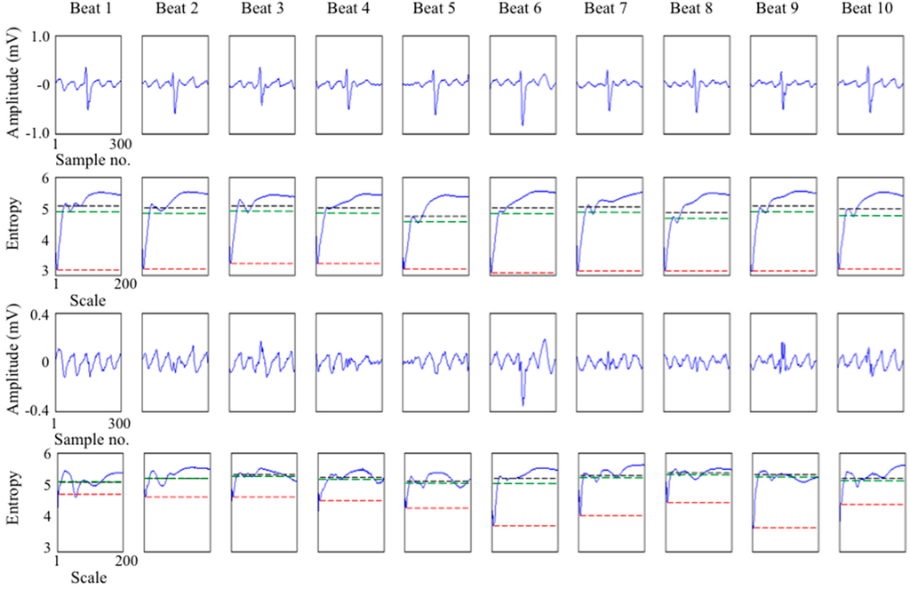 Entropy 17 06397 g003 1024