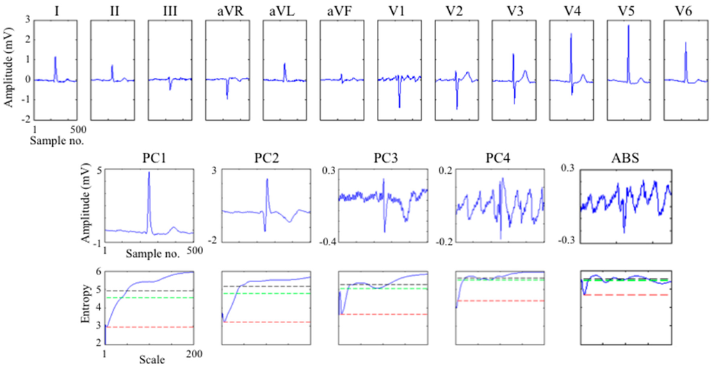 Entropy 17 06397 g005 1024