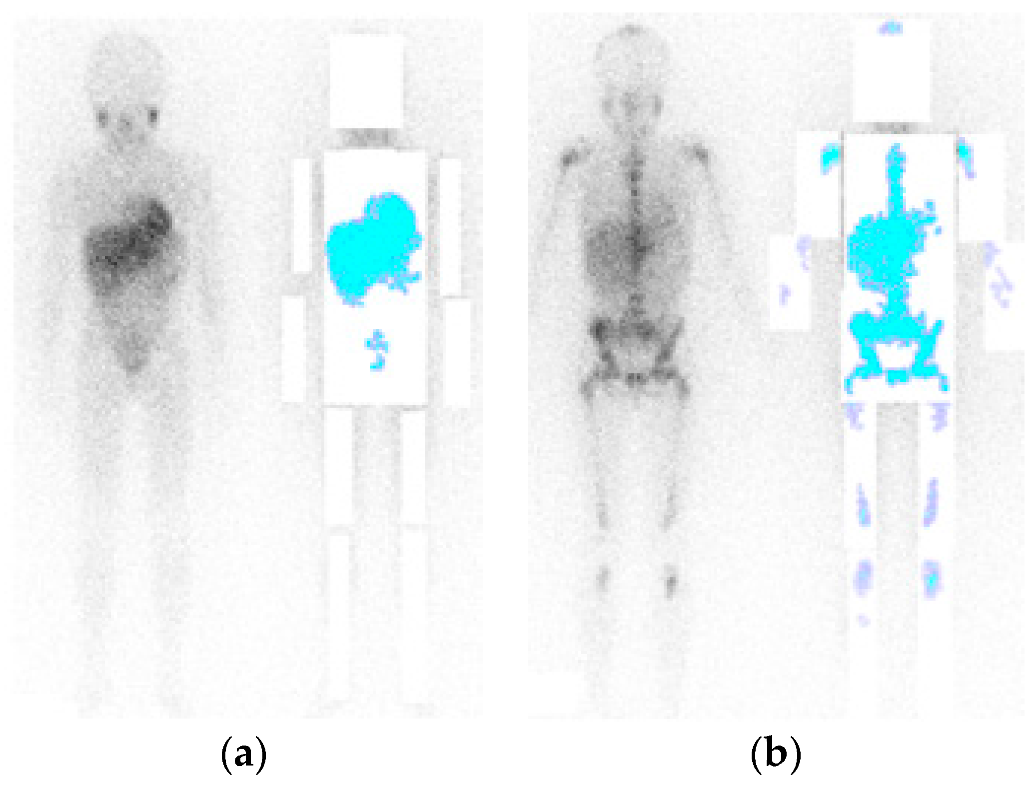 Entropy 18 00349 g002
