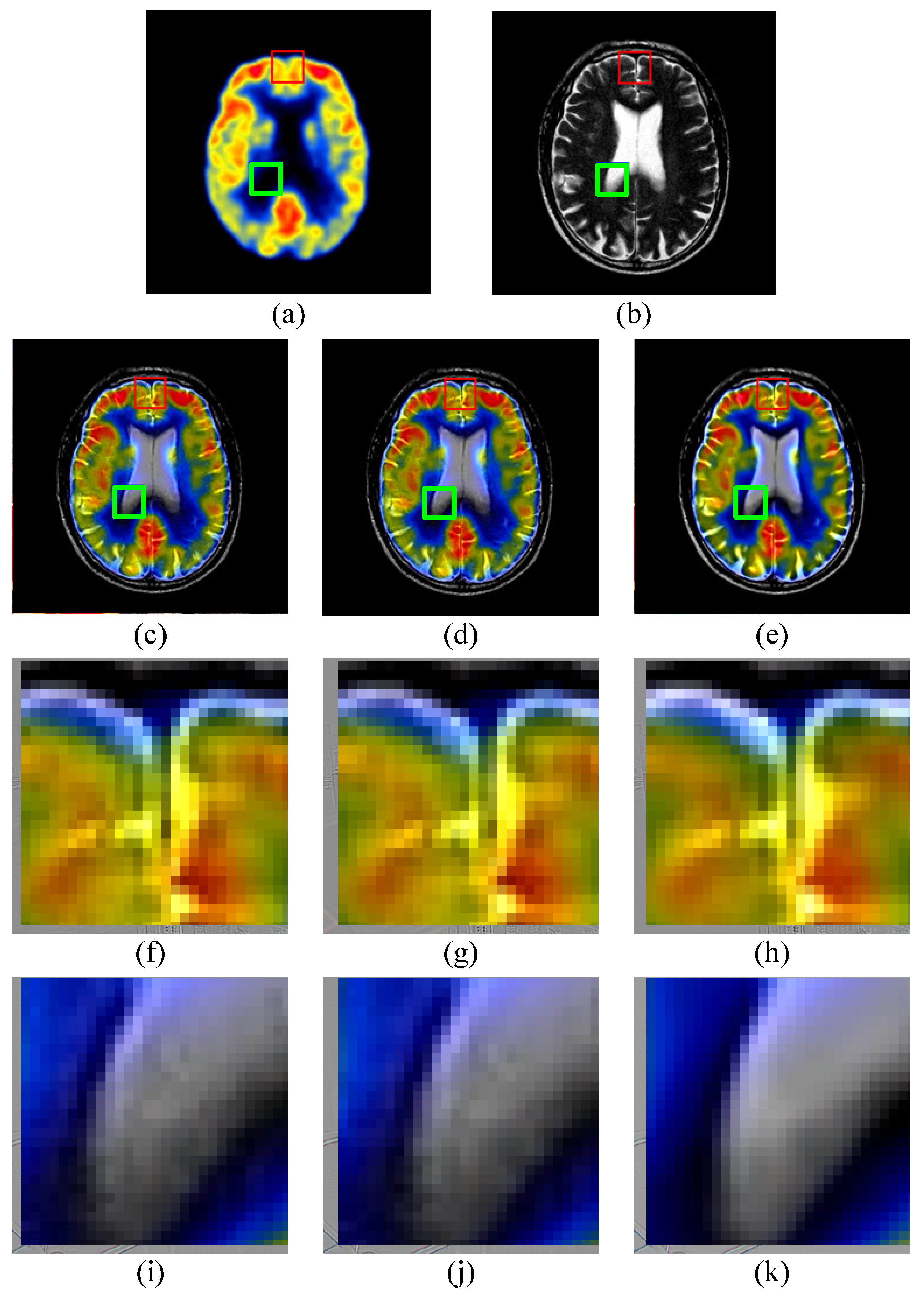 Entropy 19 00306 g005