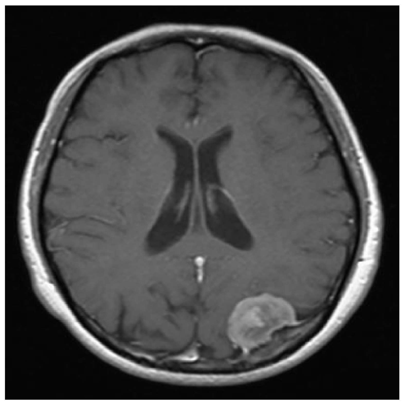 Entropy 20 00046 g012