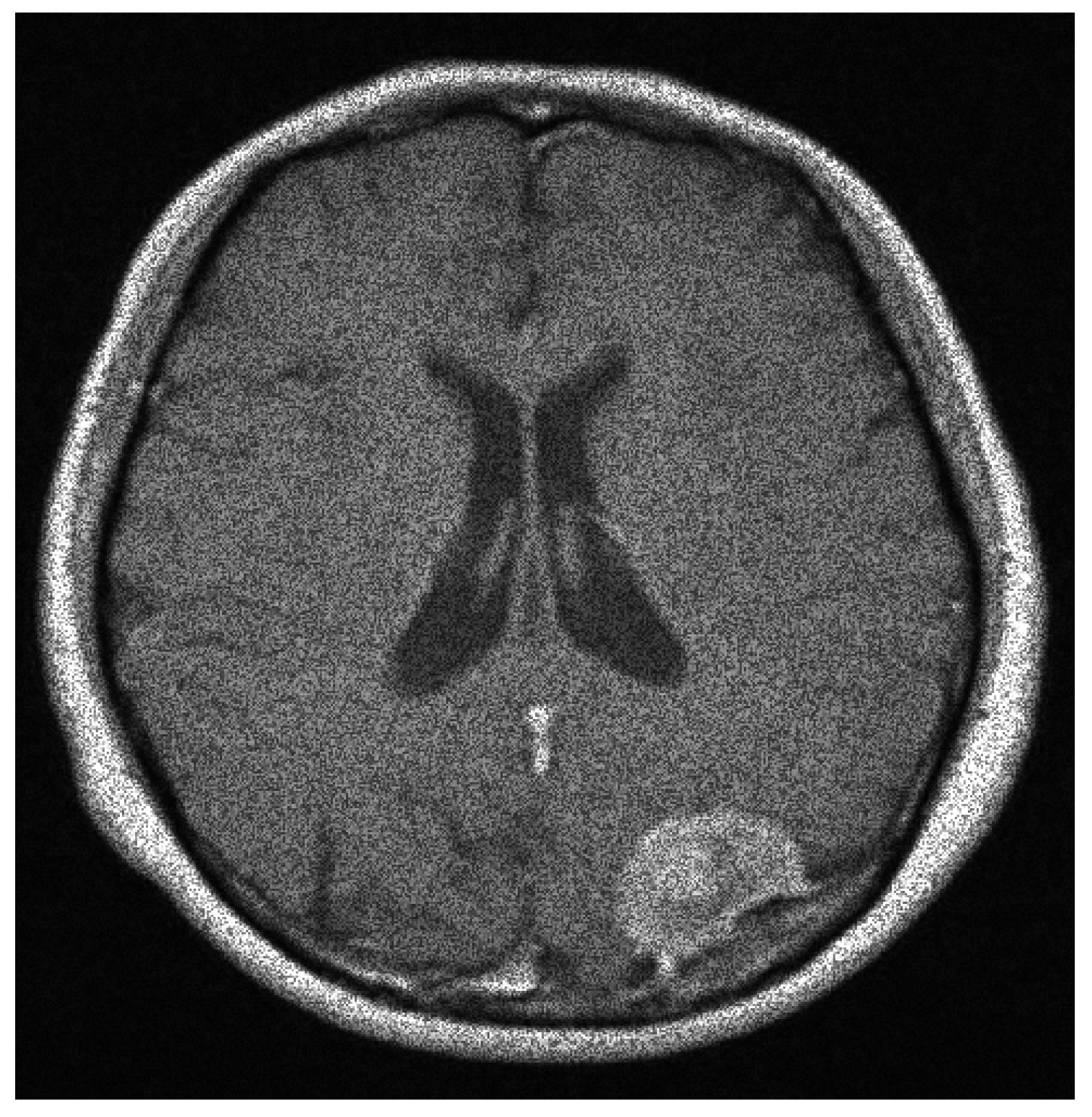 Entropy 20 00046 g013