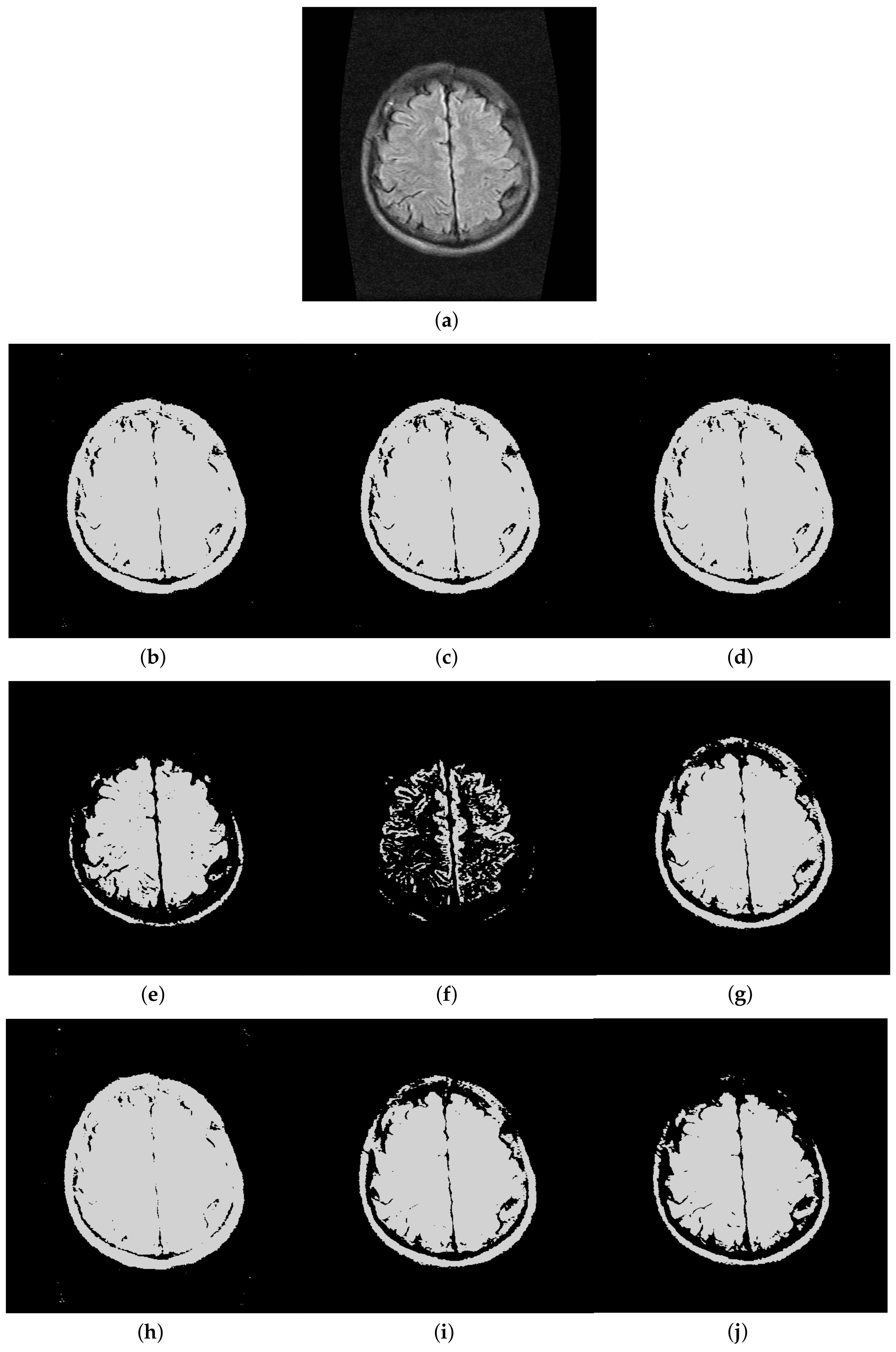 Entropy 20 00239 g008