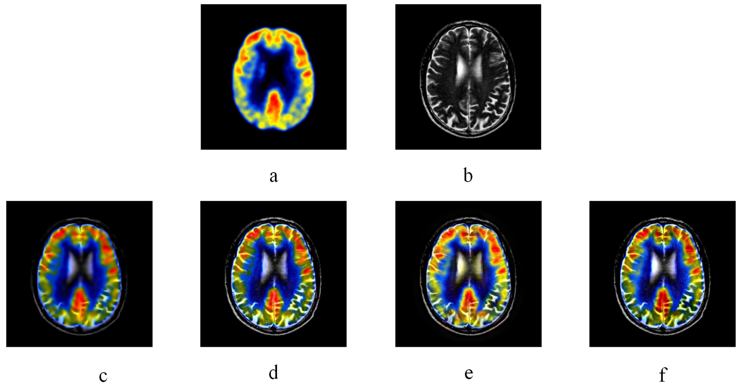 Entropy 20 00522 g006