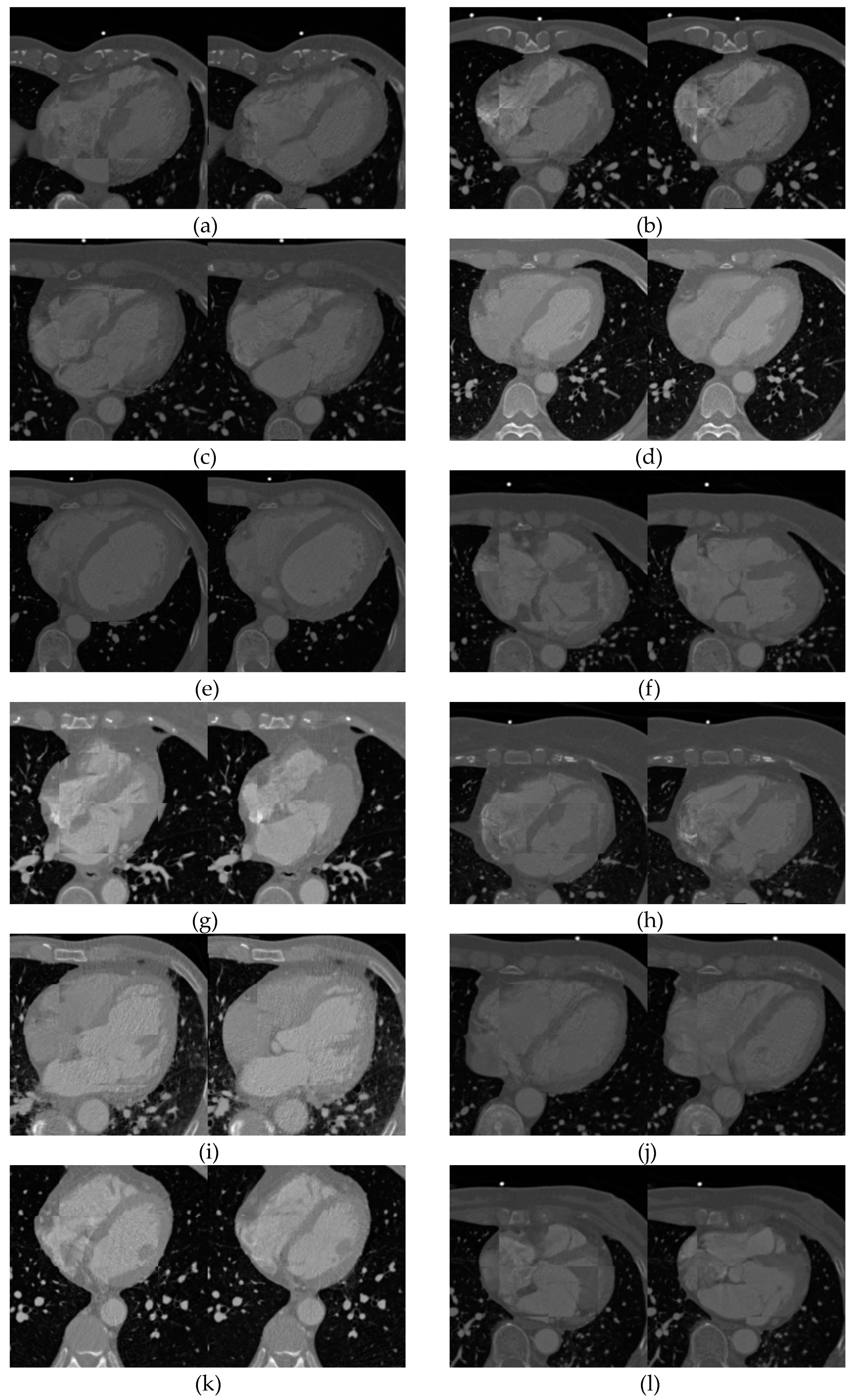 Entropy 21 00189 g008