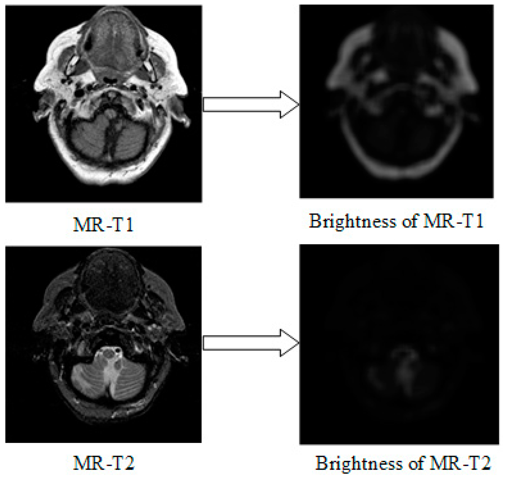 Entropy 21 00267 g004