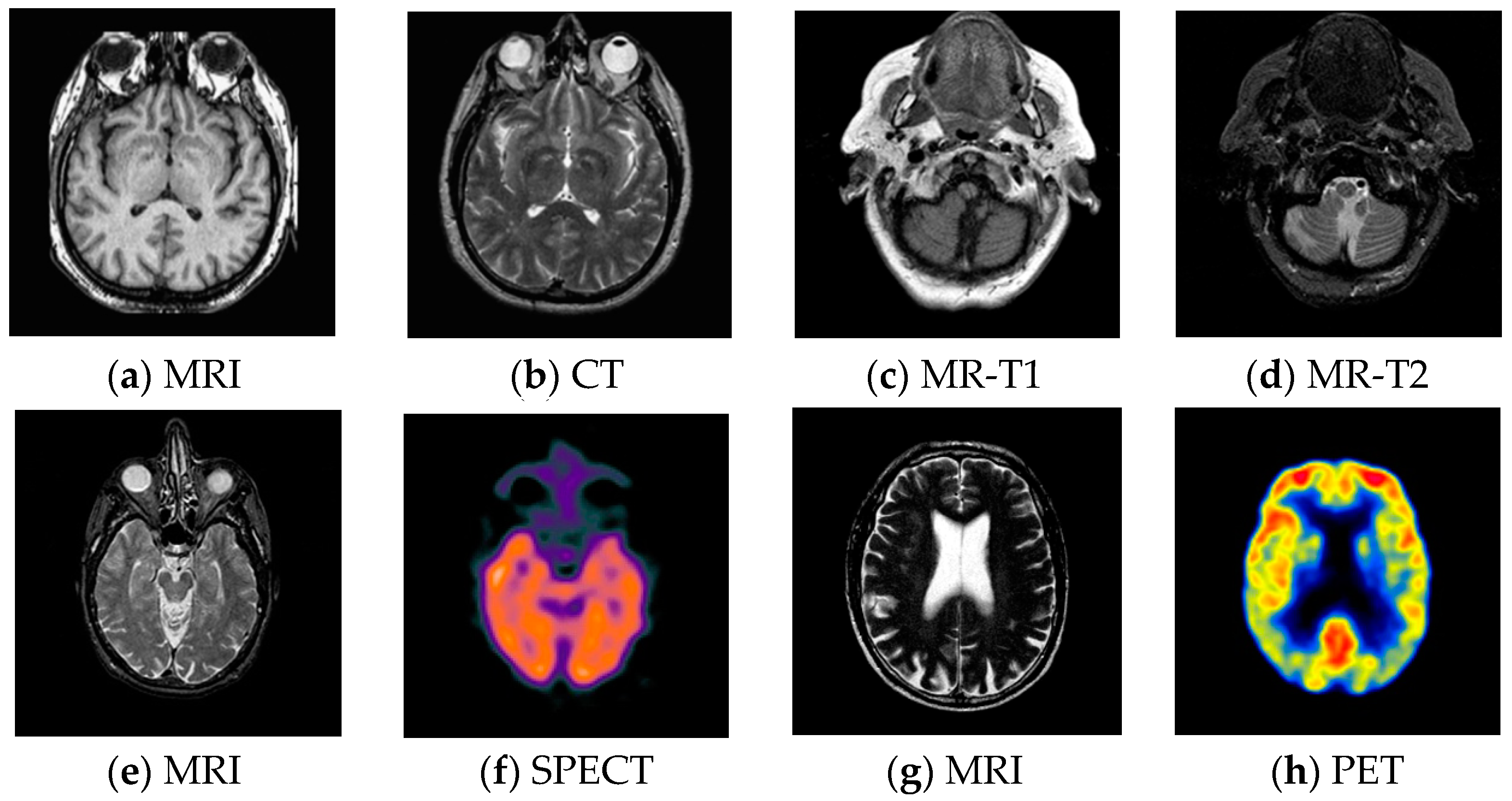 Entropy 21 00267 g006