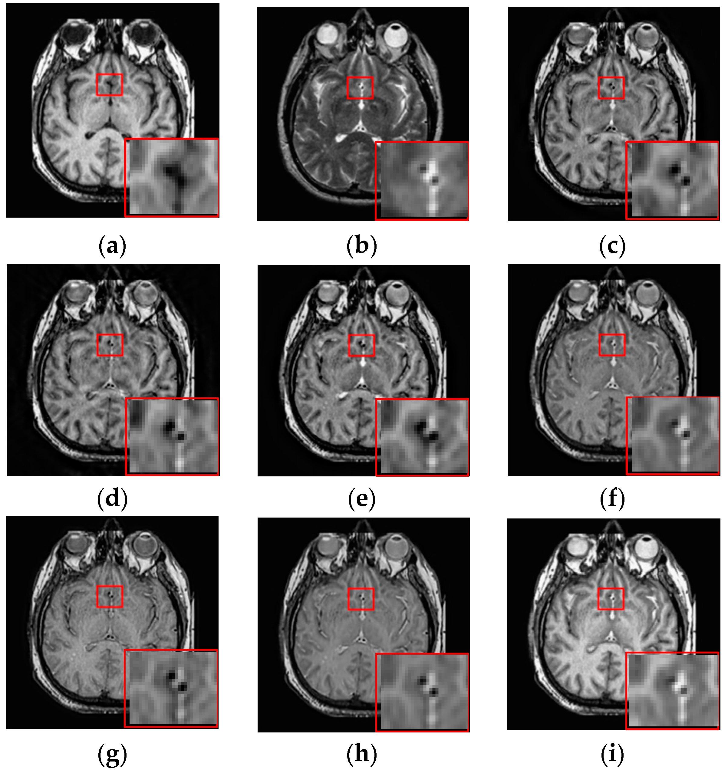 Entropy 21 00267 g007