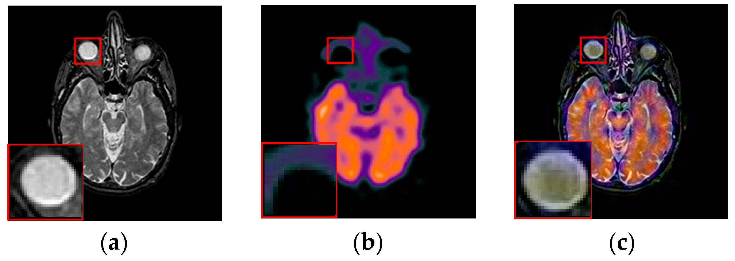 Entropy 21 00267 g009a