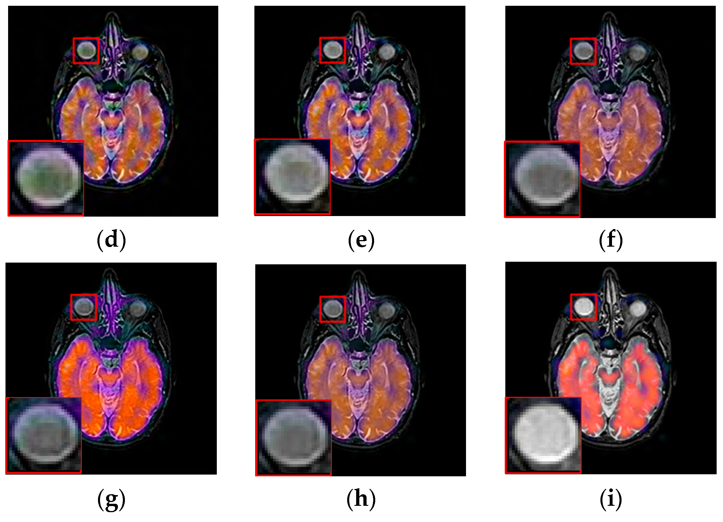 Entropy 21 00267 g009b