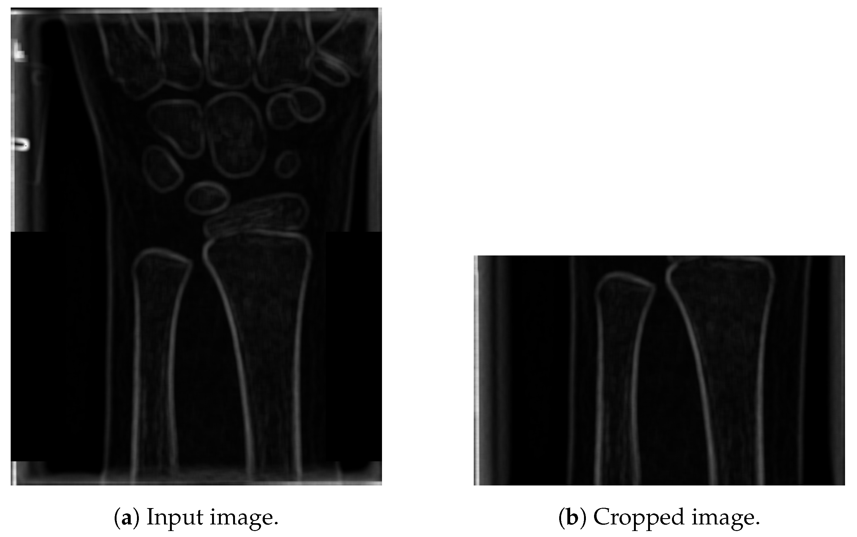 Entropy 21 00338 g006