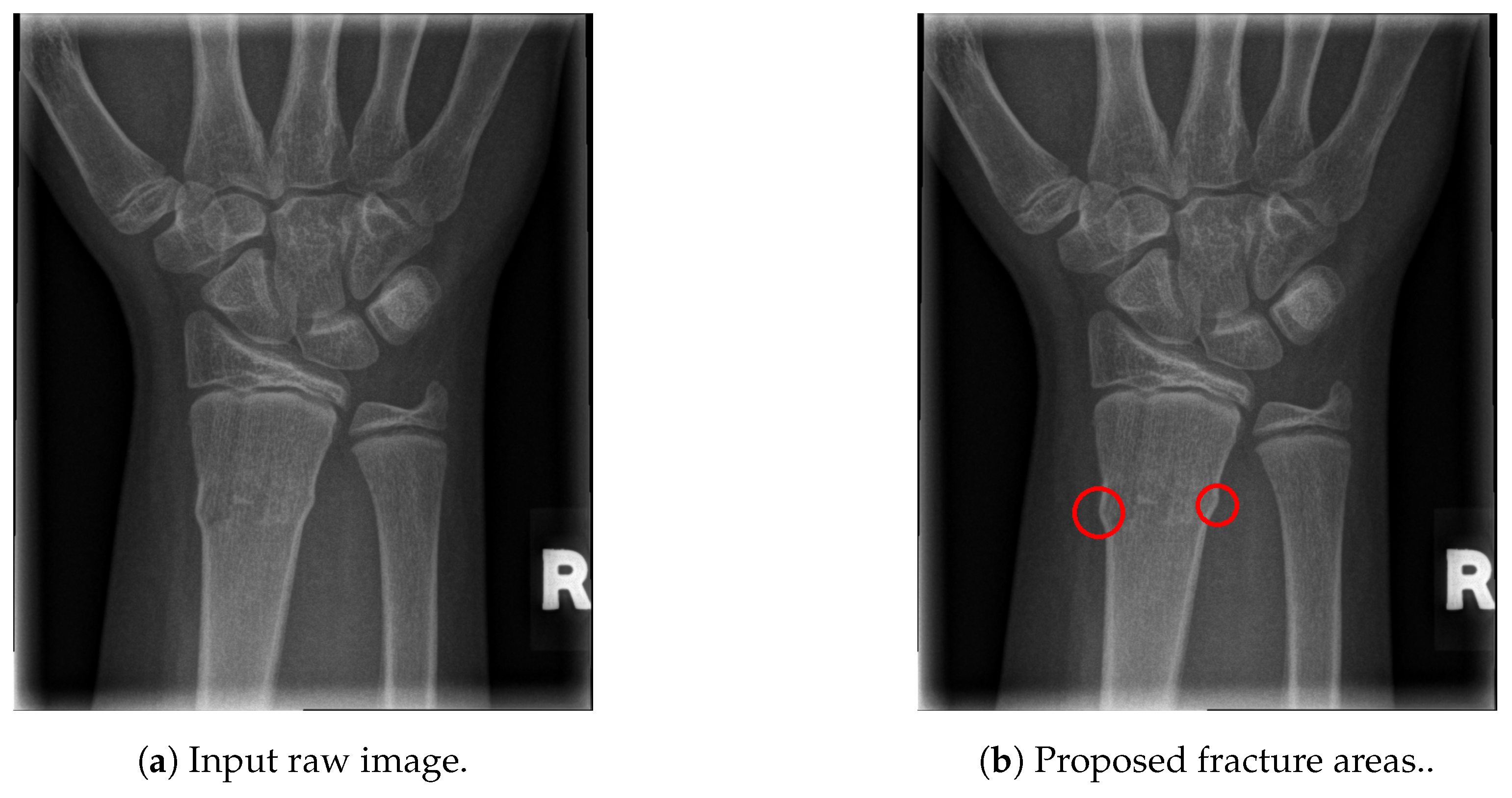 Entropy 21 00338 g016