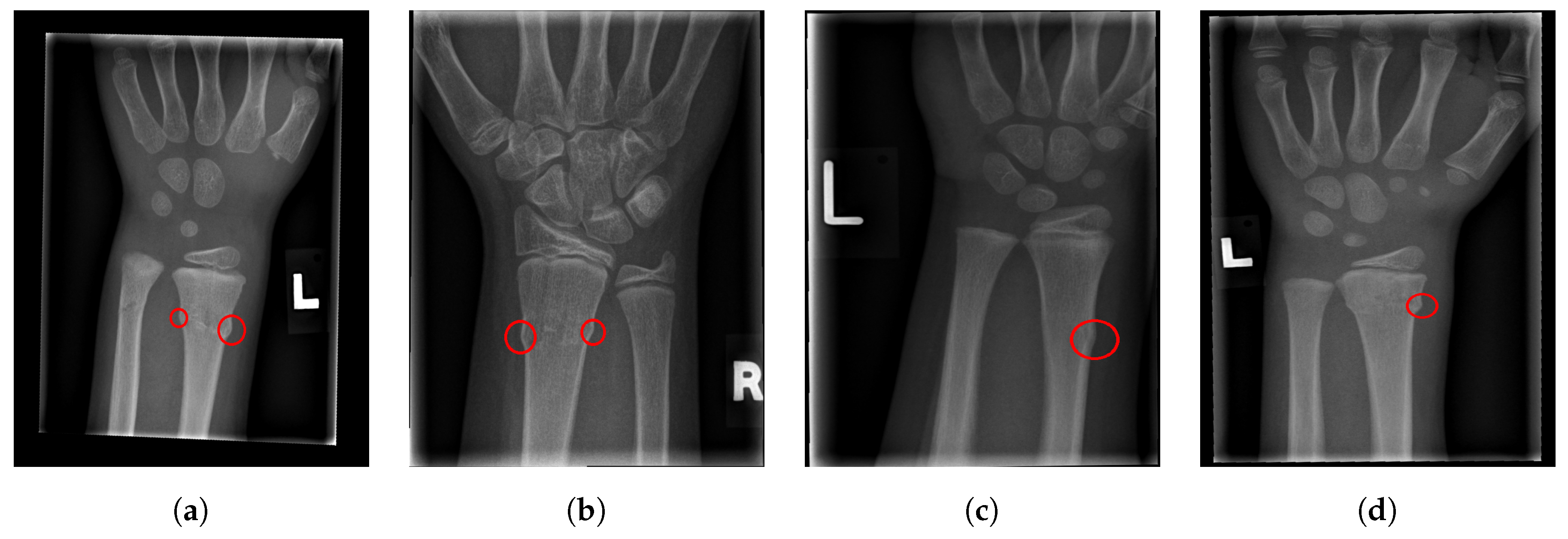 Entropy 21 00338 g017