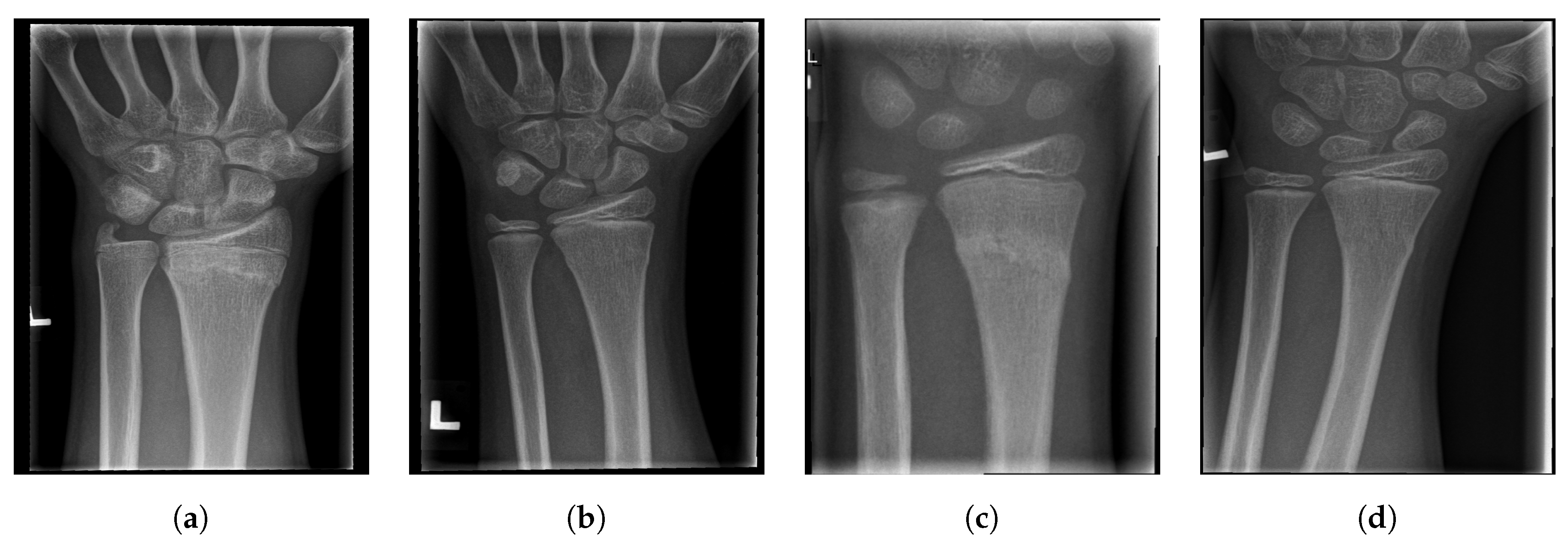 Entropy 21 00338 g020