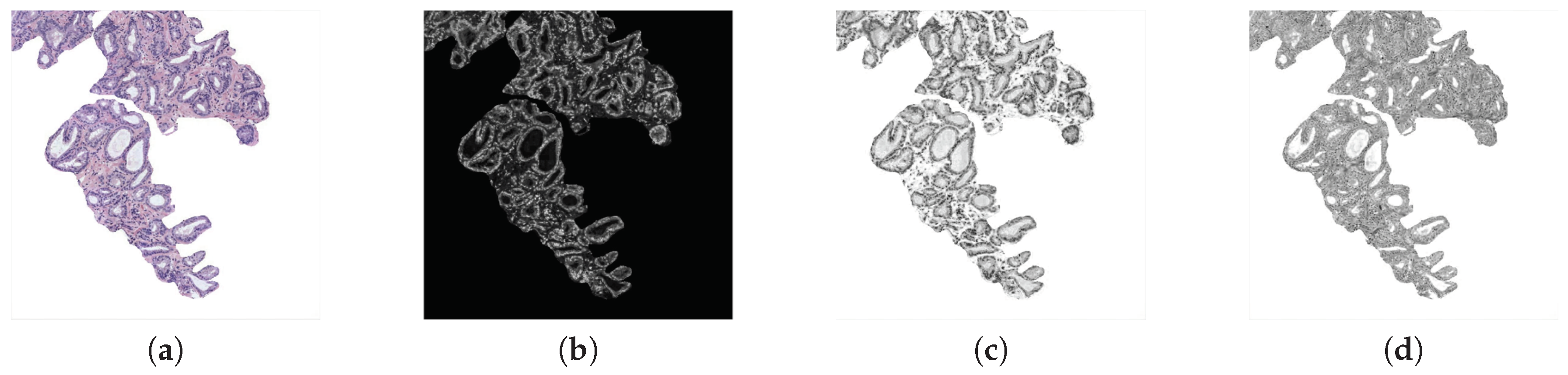 Entropy 21 00356 g006
