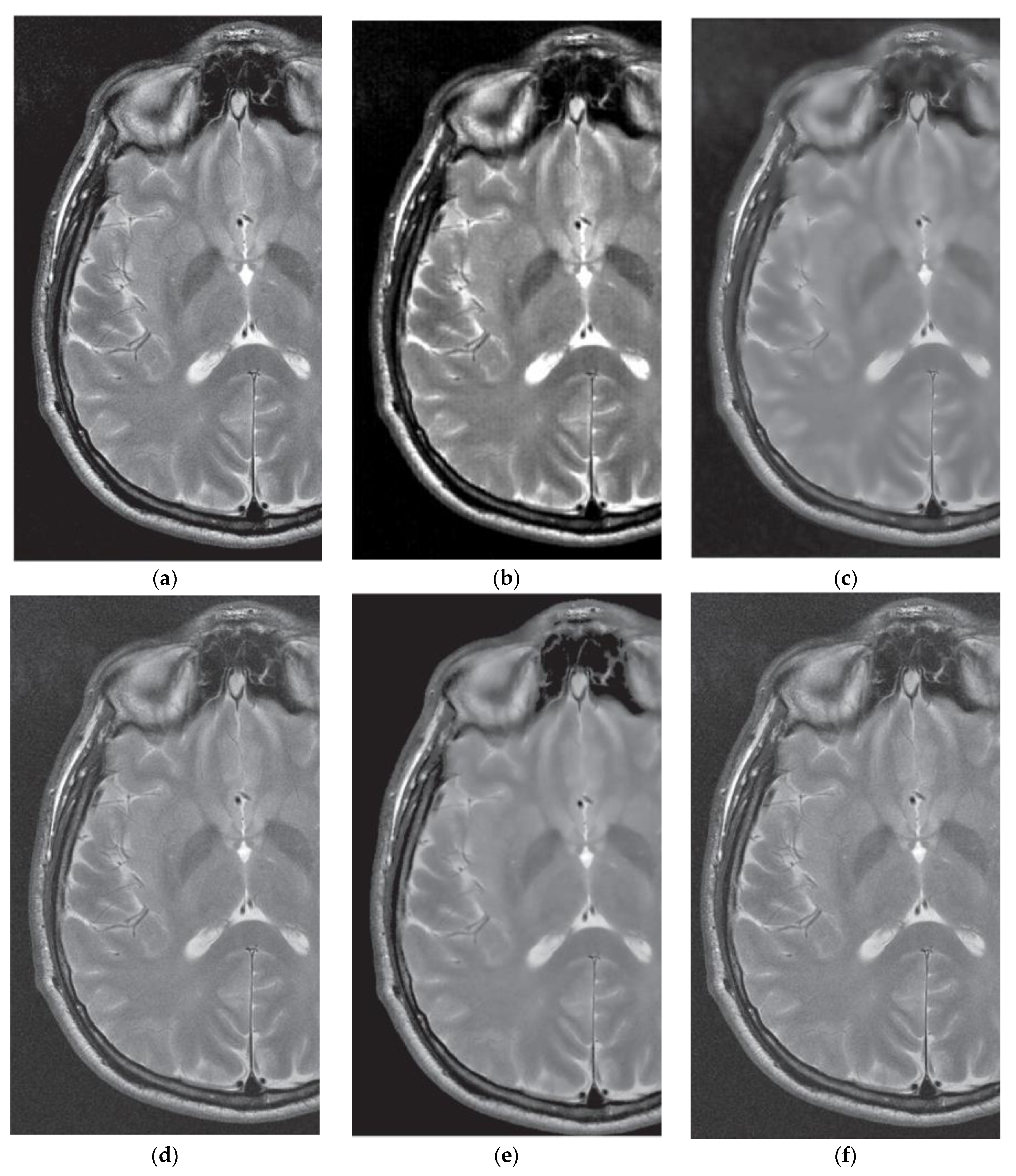 Entropy 21 00401 g010