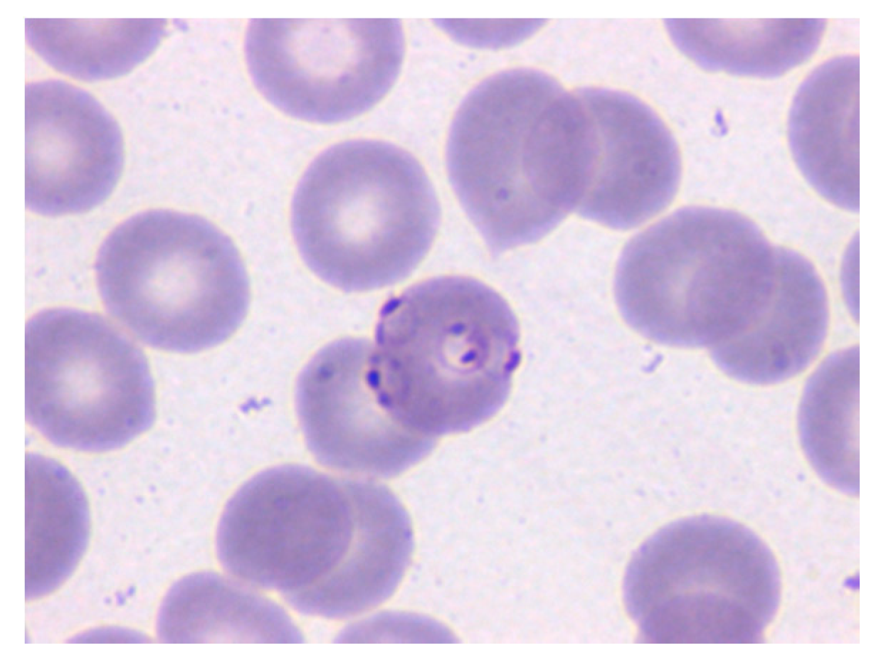 Entropy 22 00657 g001