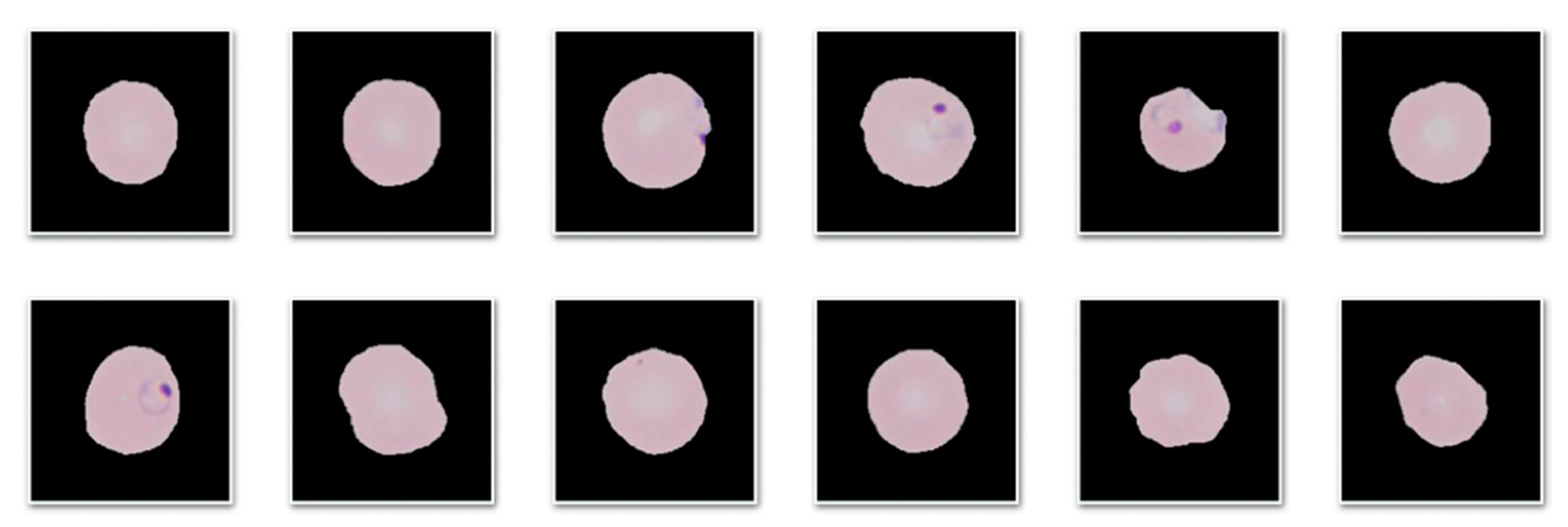 Entropy 22 00657 g007