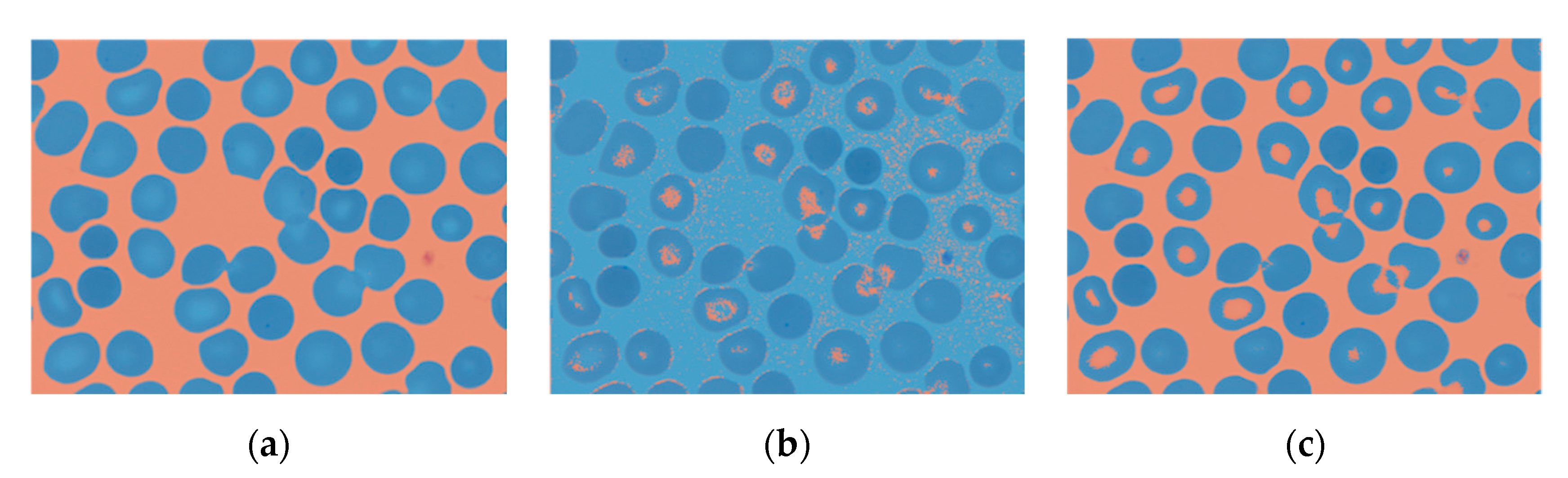 Entropy 22 00657 g009