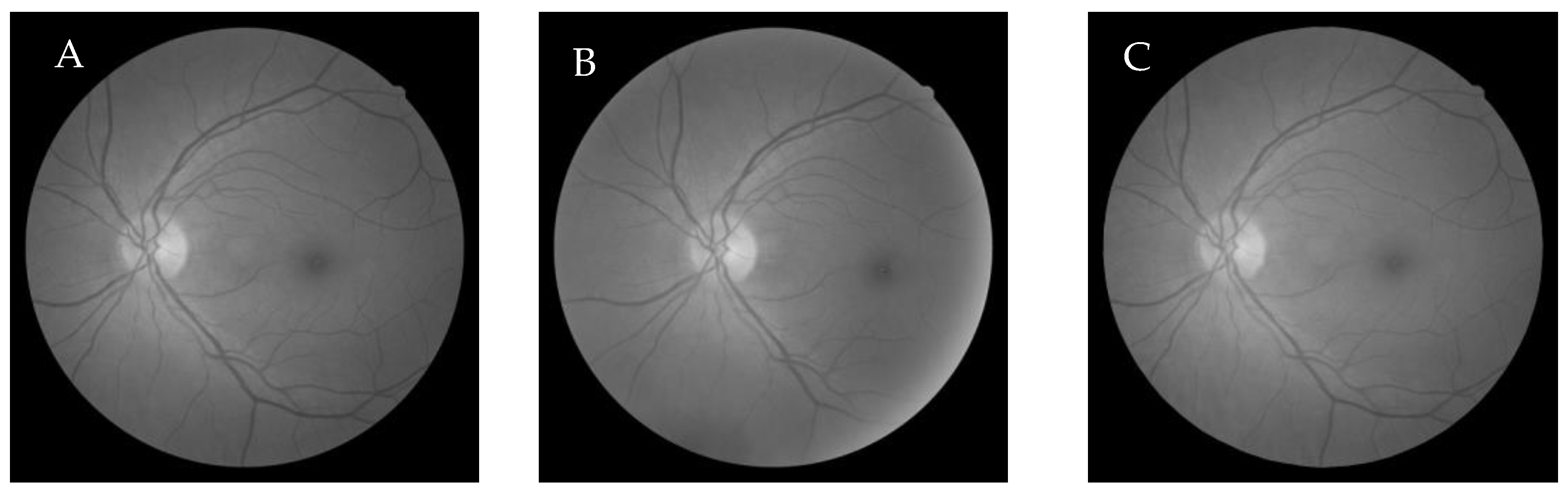 Entropy 22 00659 g004