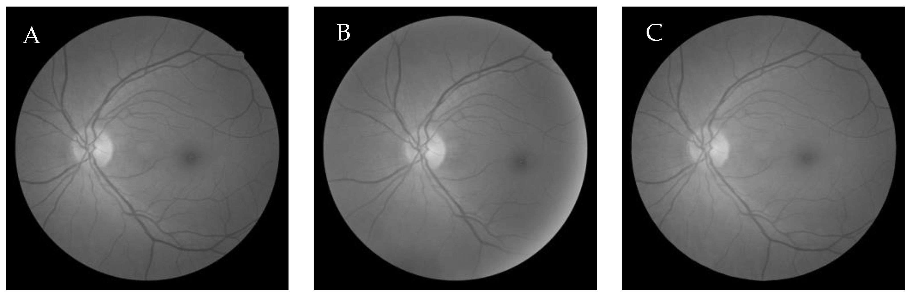 Entropy 22 00659 g011