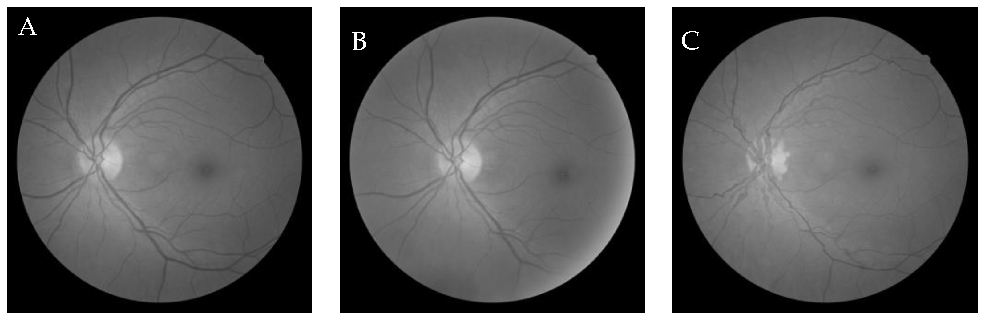 Entropy 22 00659 g012