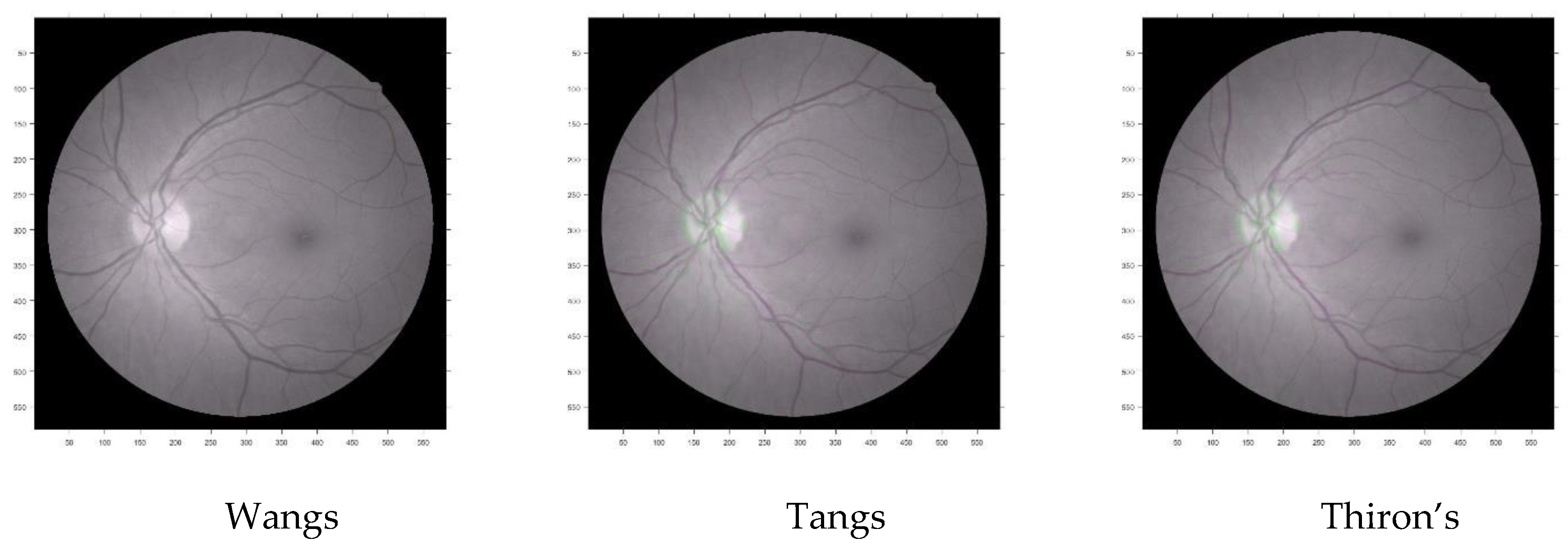 Entropy 22 00659 g016