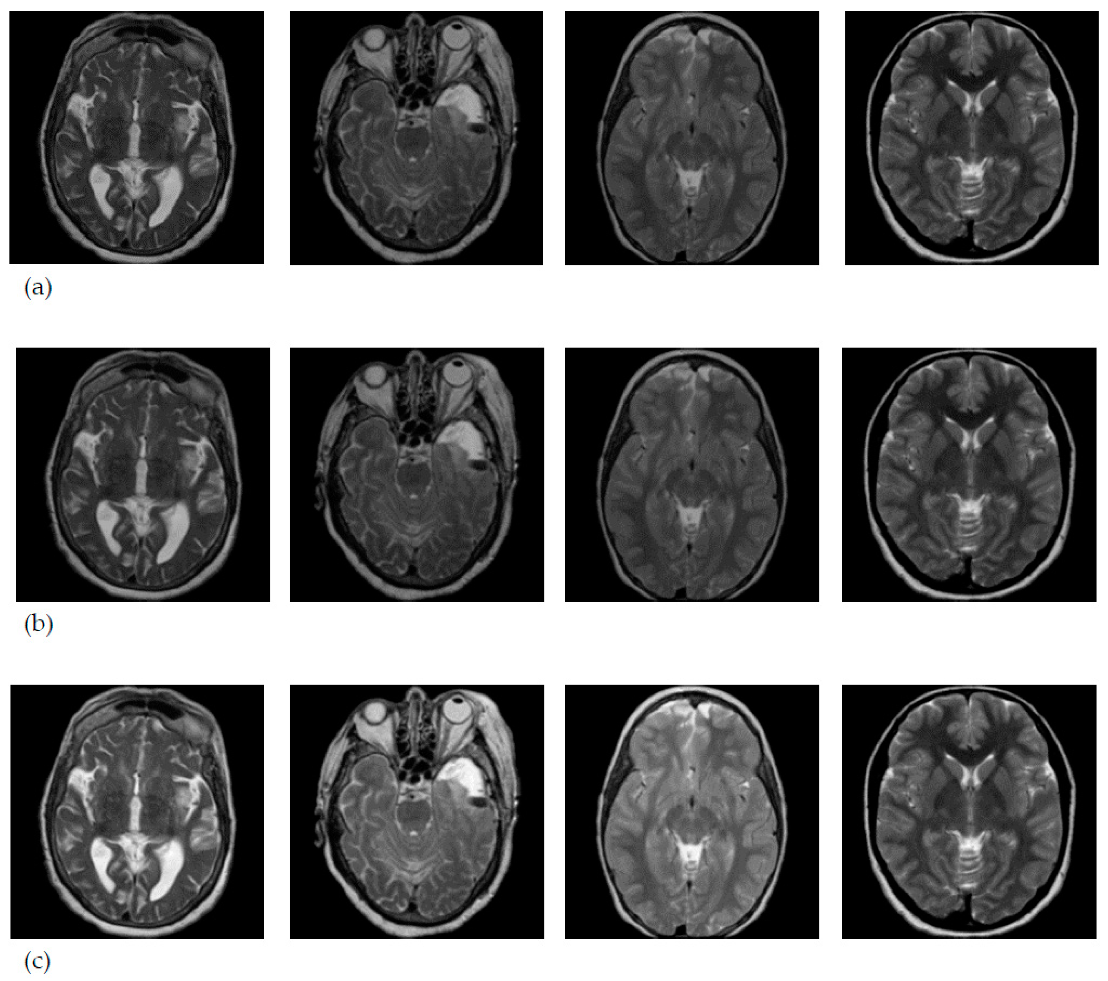 Entropy 22 01033 g004