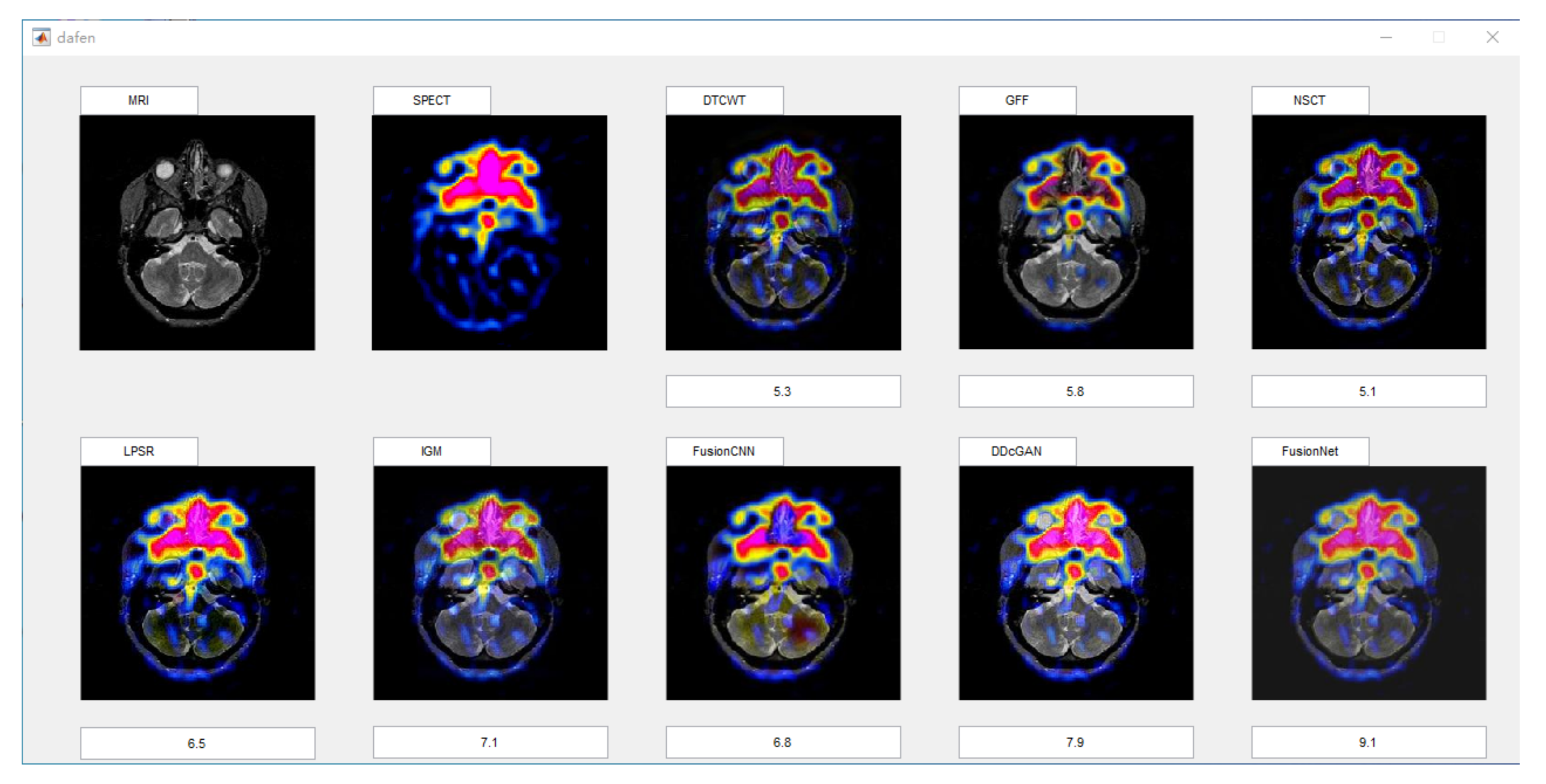 Entropy 22 01423 g005