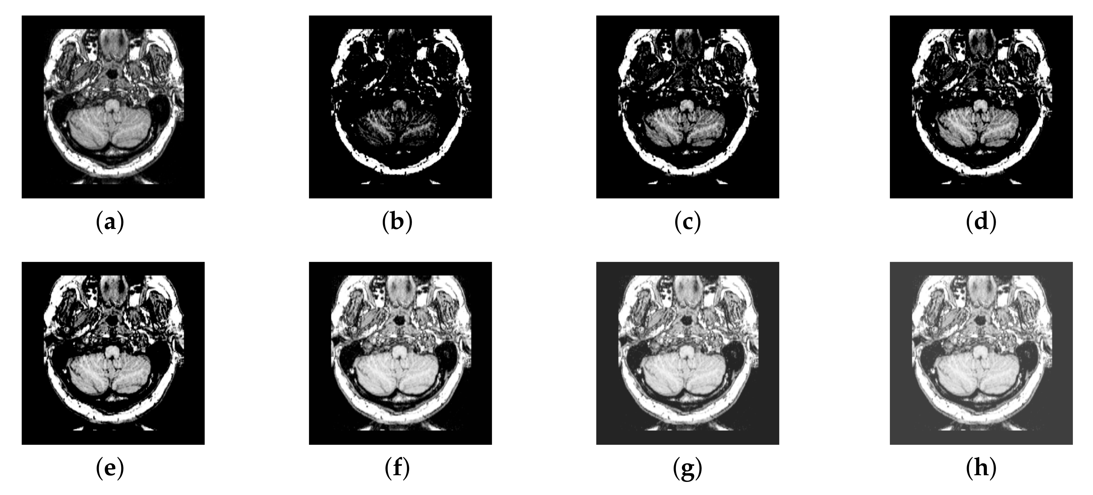 Entropy 22 01423 g006