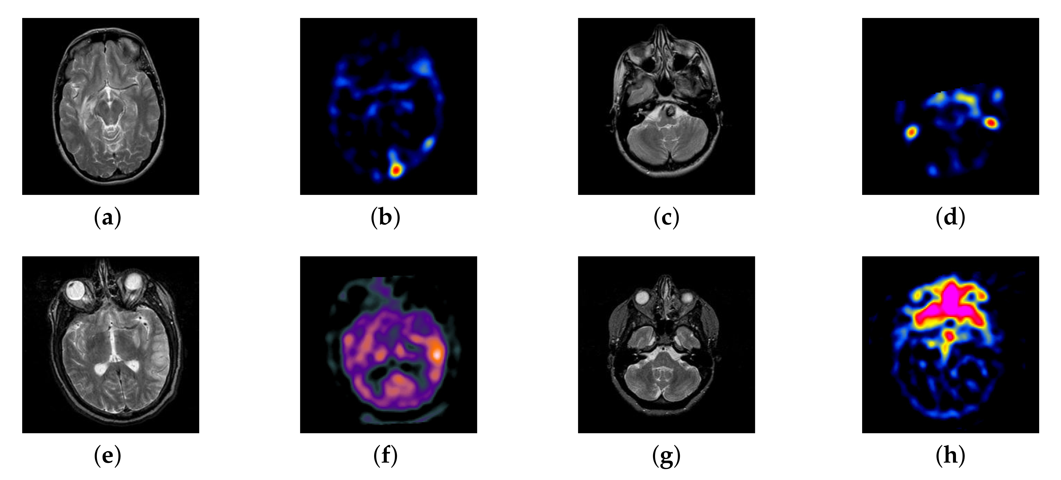 Entropy 22 01423 g007