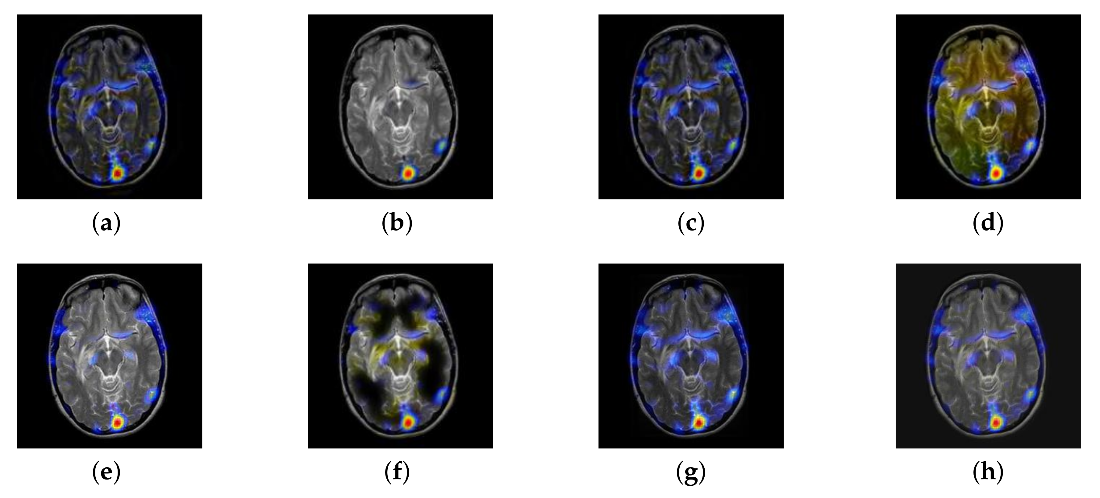 Entropy 22 01423 g008