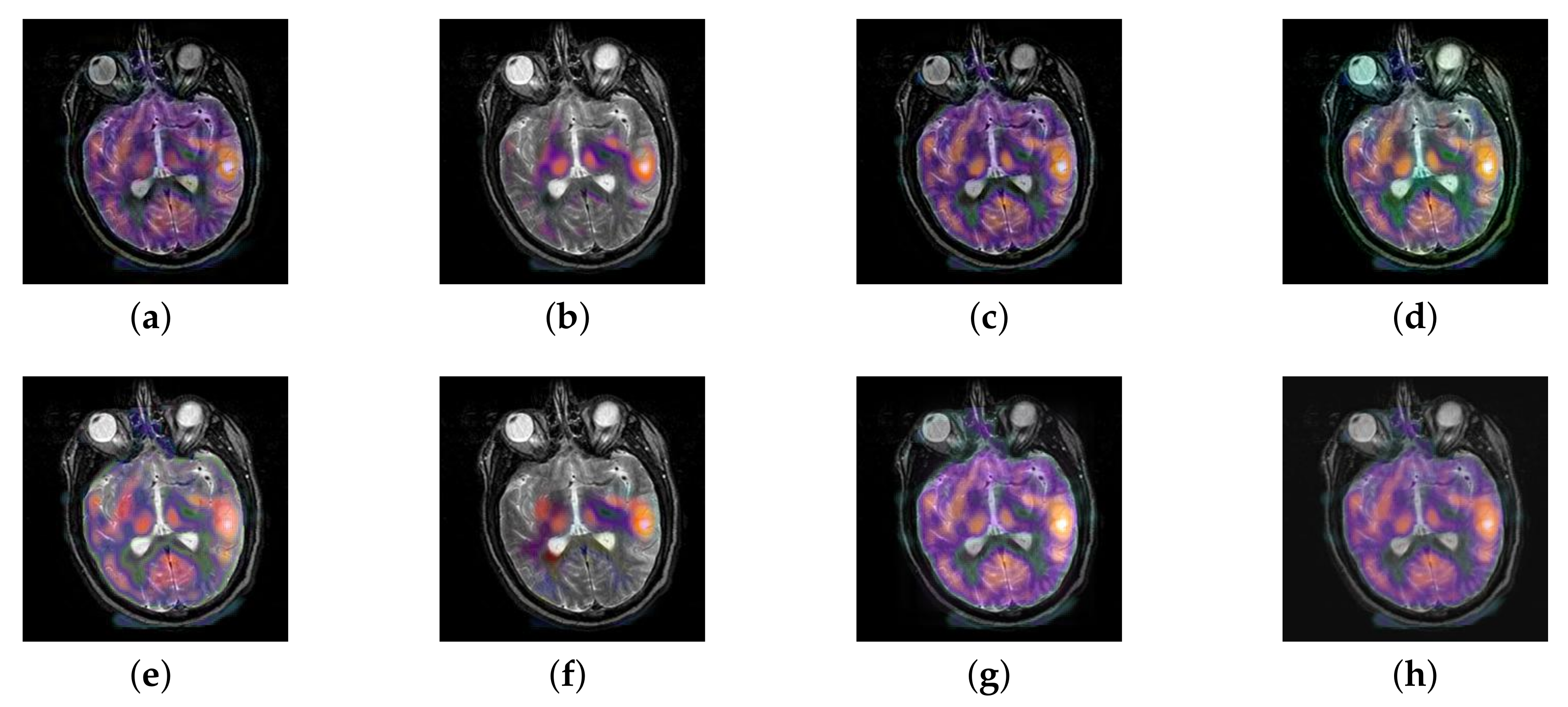 Entropy 22 01423 g010