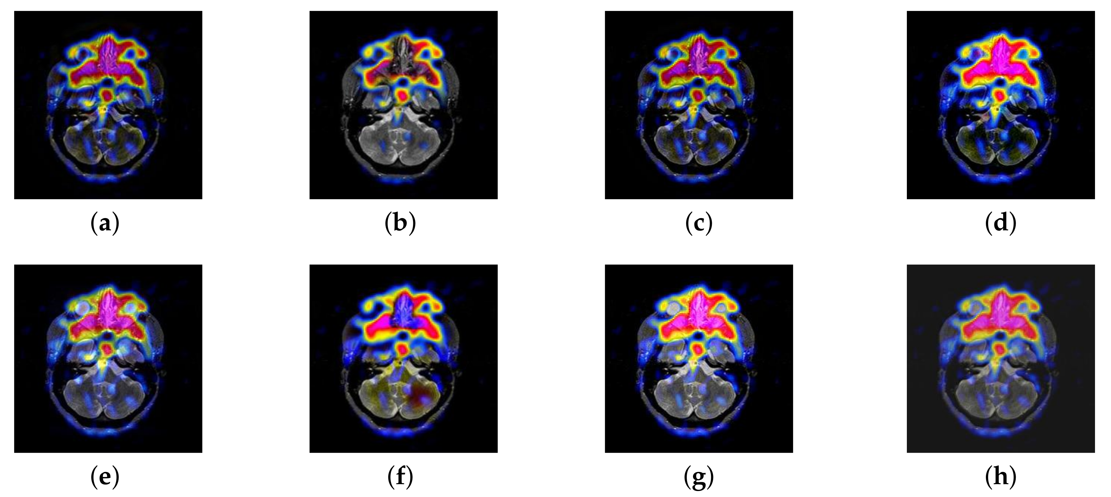 Entropy 22 01423 g011