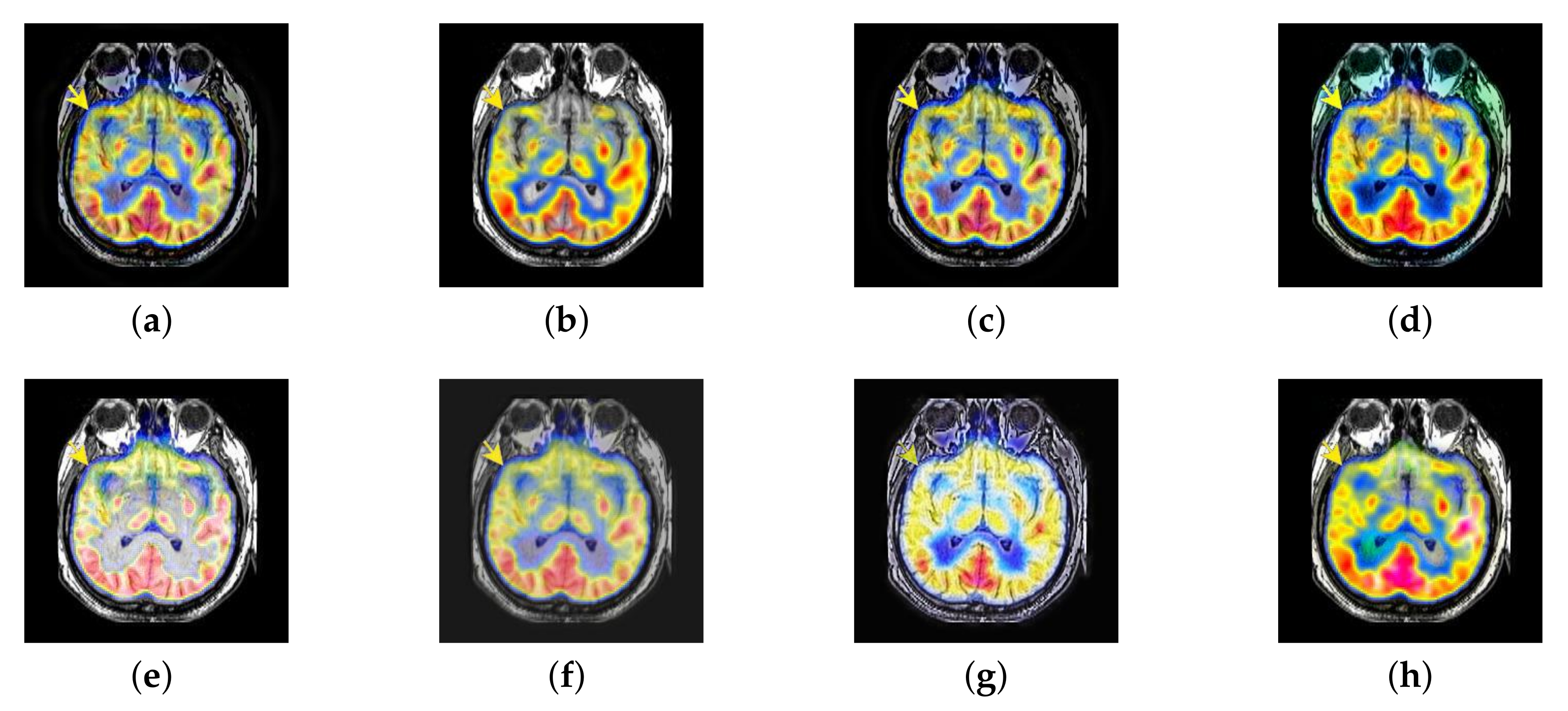 Entropy 22 01423 g026
