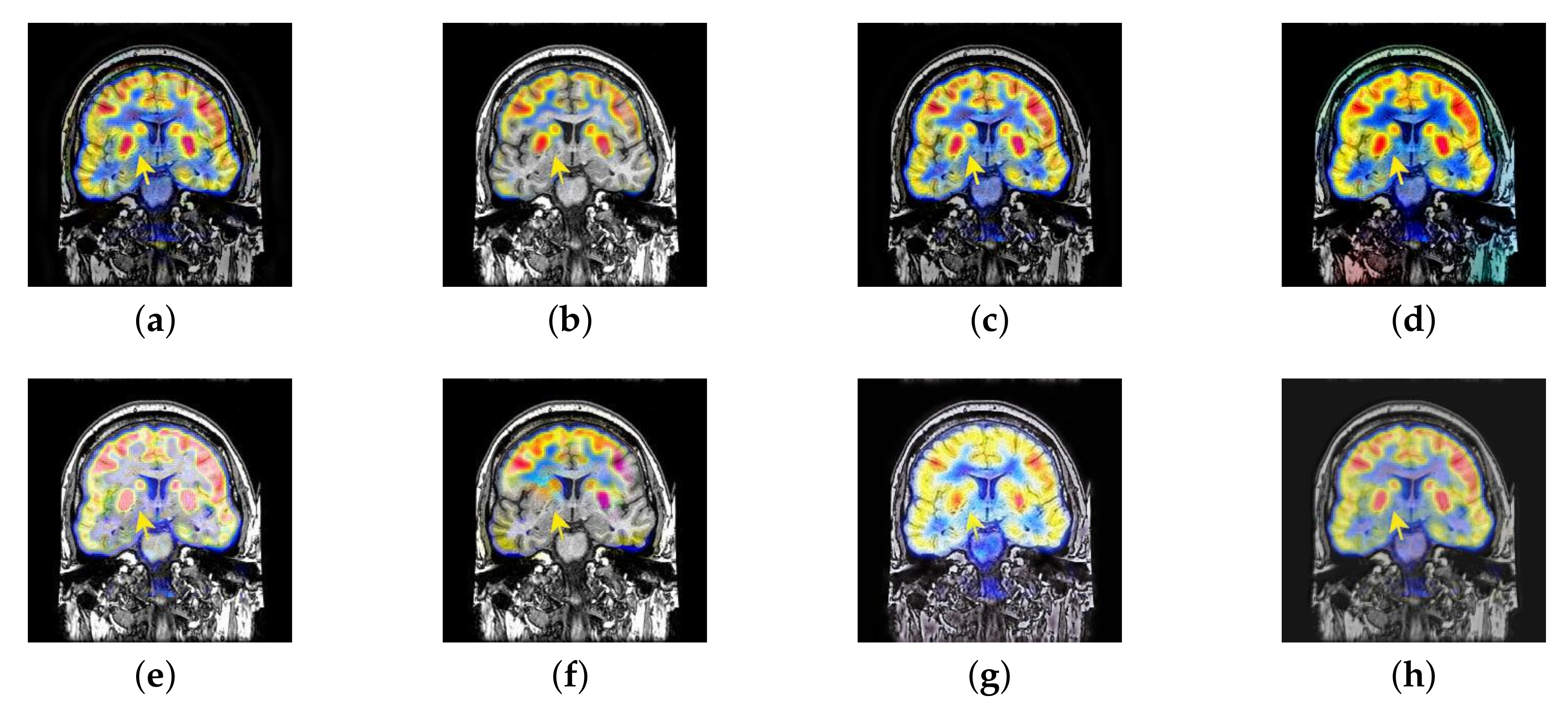Entropy 22 01423 g027