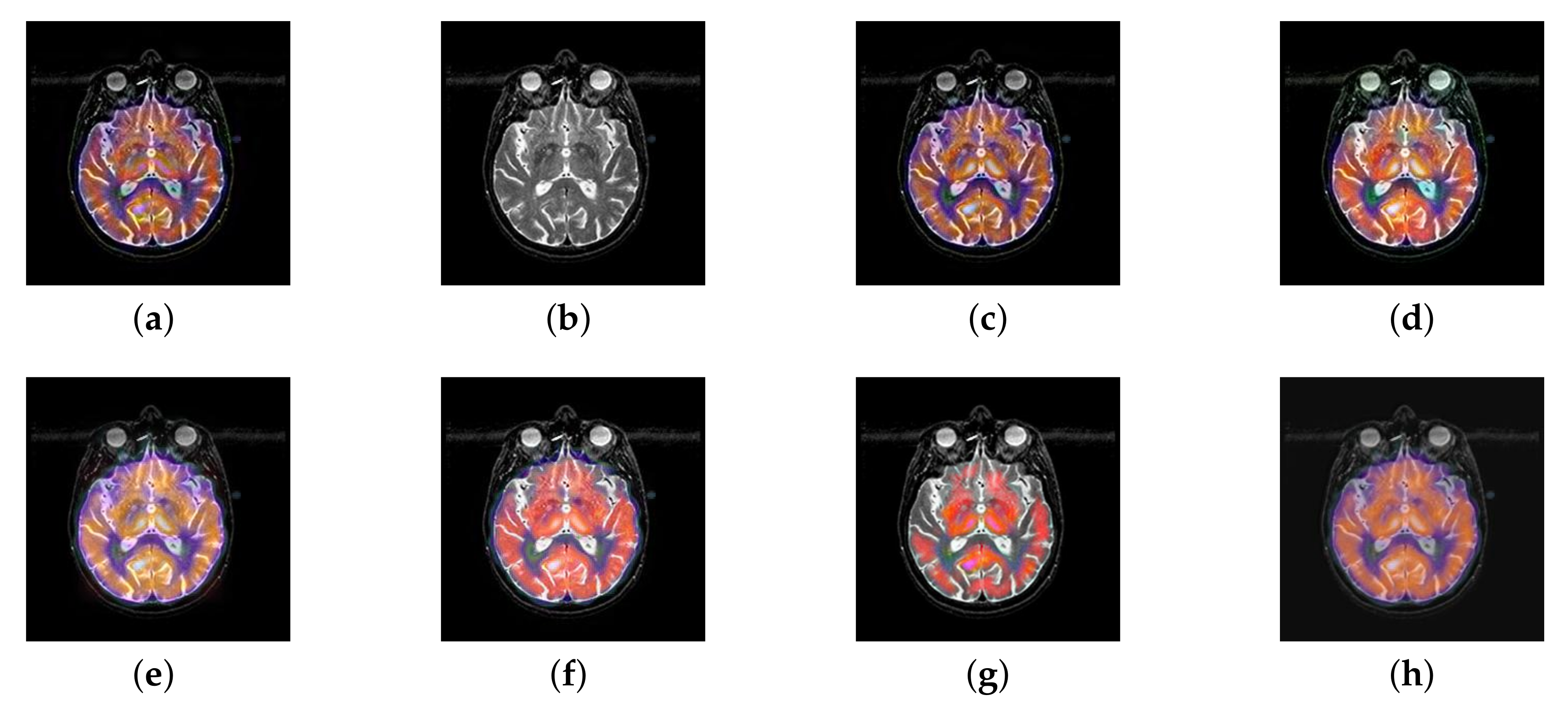 Entropy 22 01423 g043