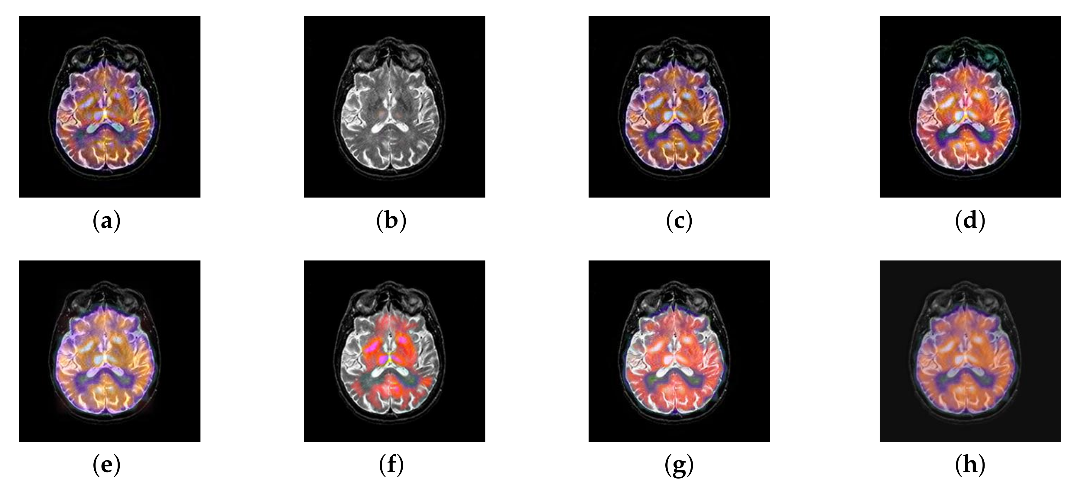 Entropy 22 01423 g044