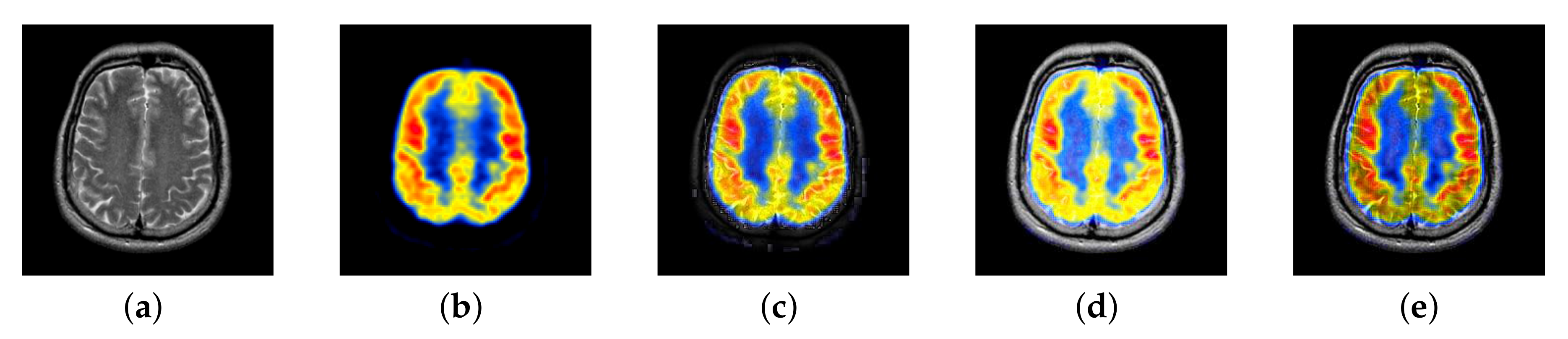 Entropy 22 01423 g058
