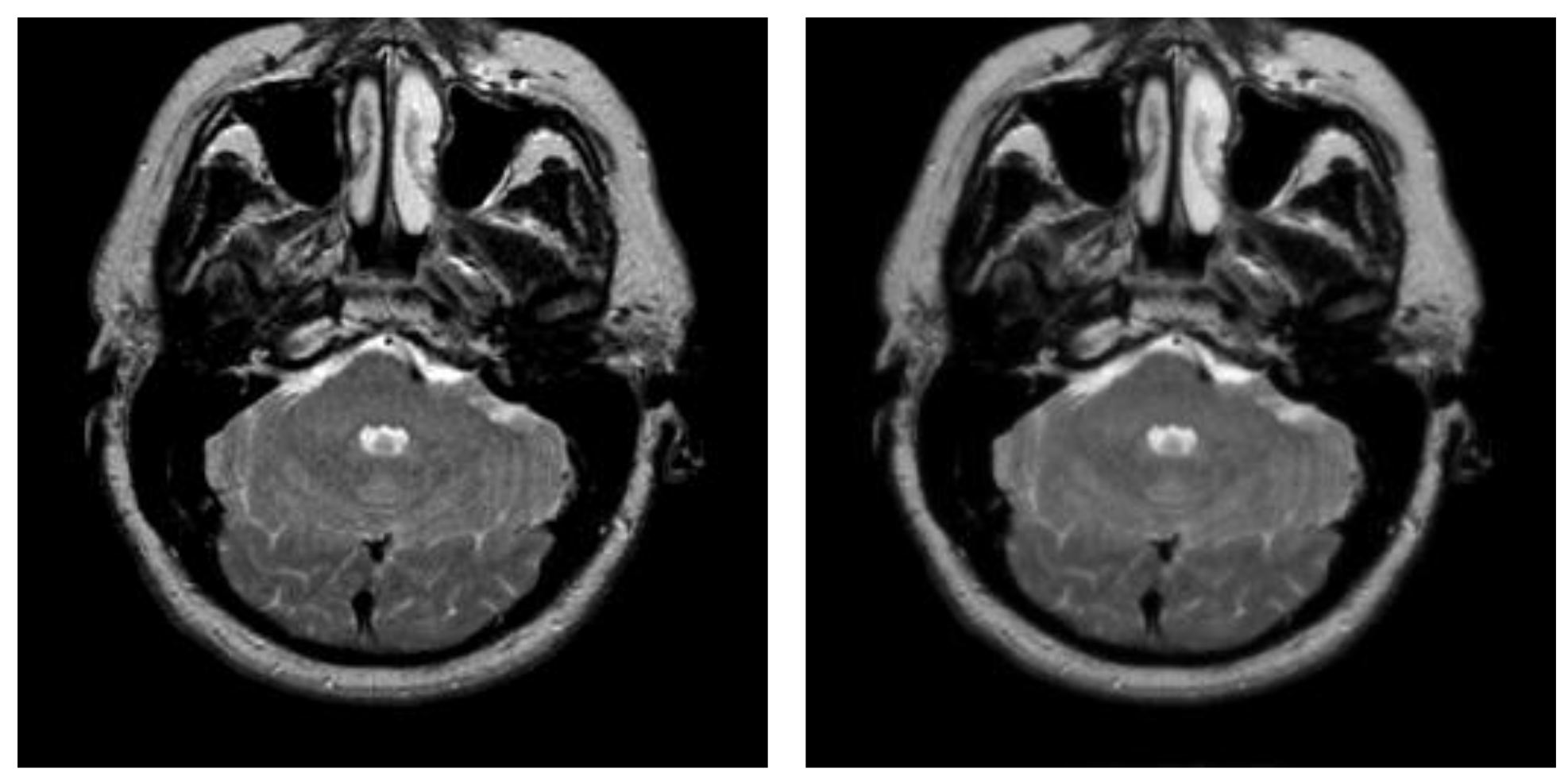 Entropy 23 01429 g007a