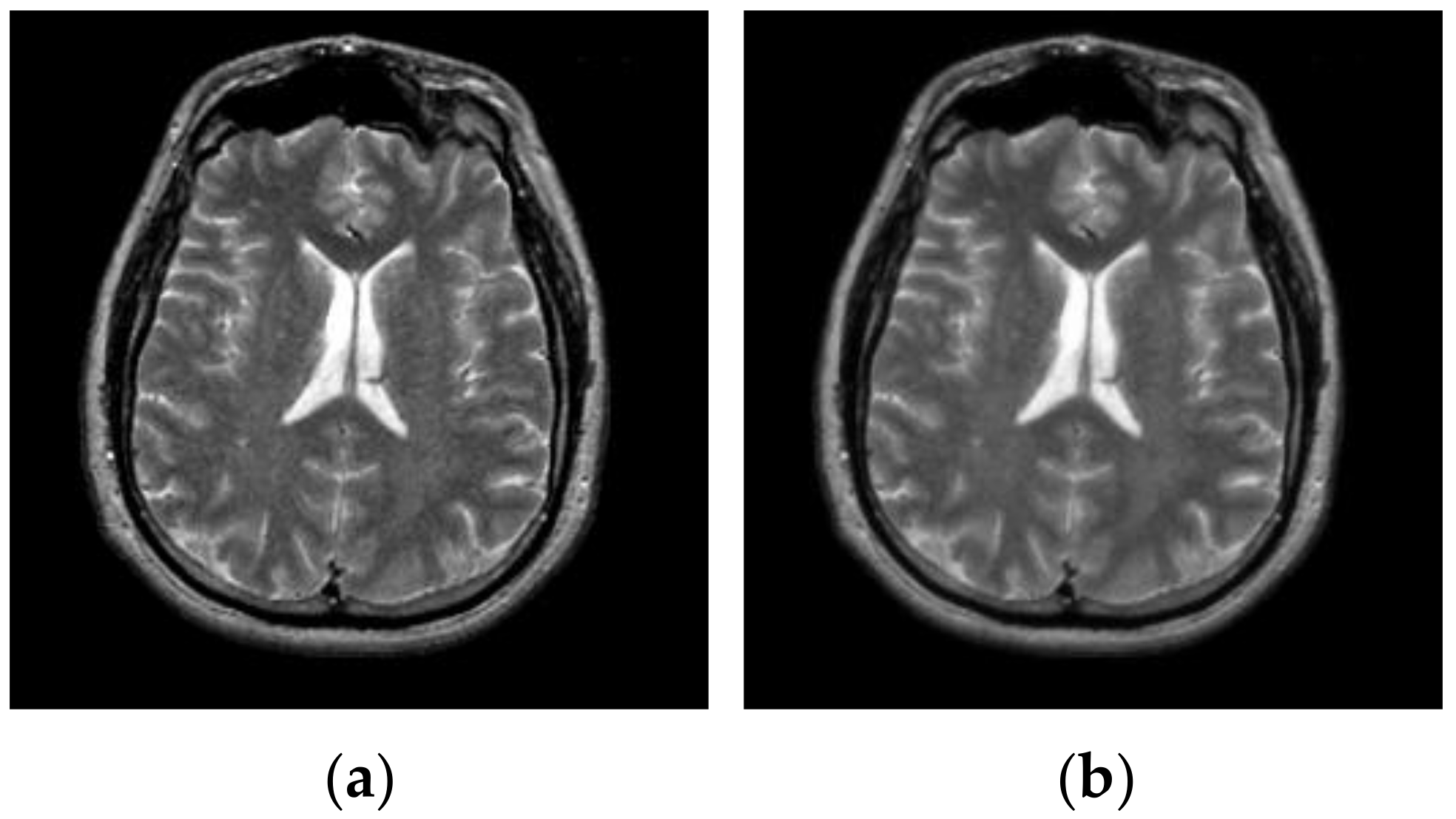 Entropy 23 01429 g007b
