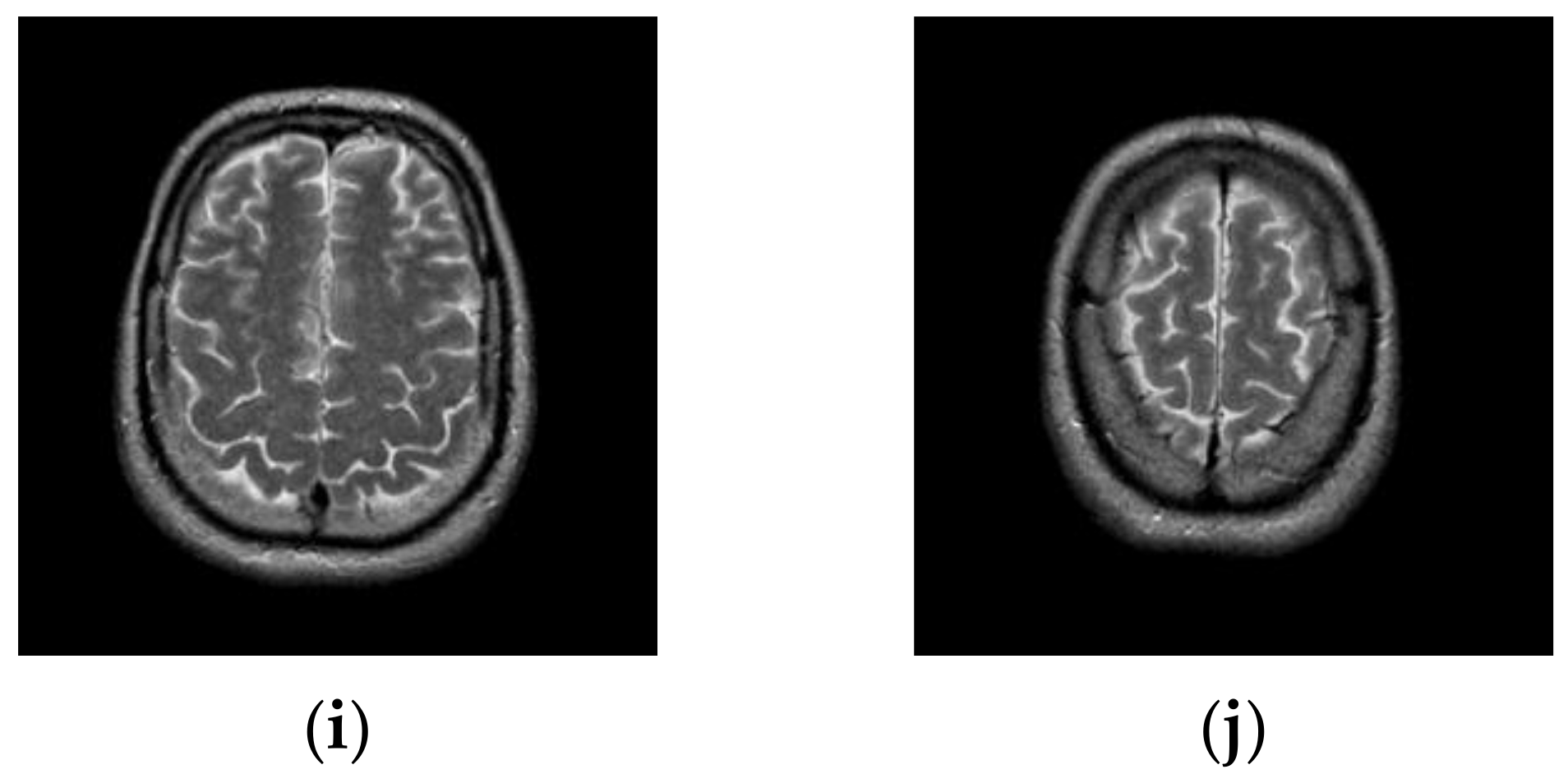 Entropy 23 01429 g009b