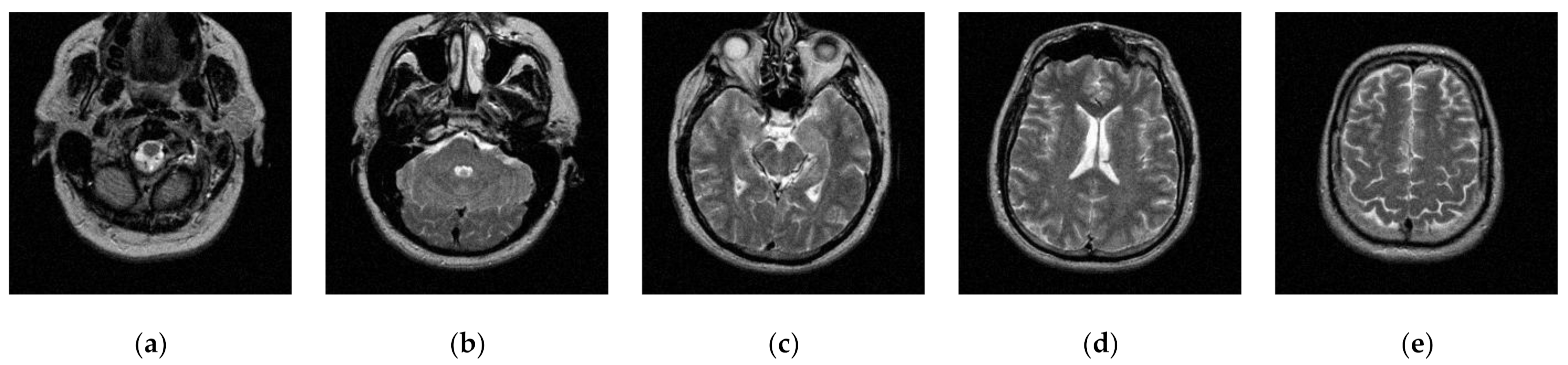 Entropy 23 01429 g013