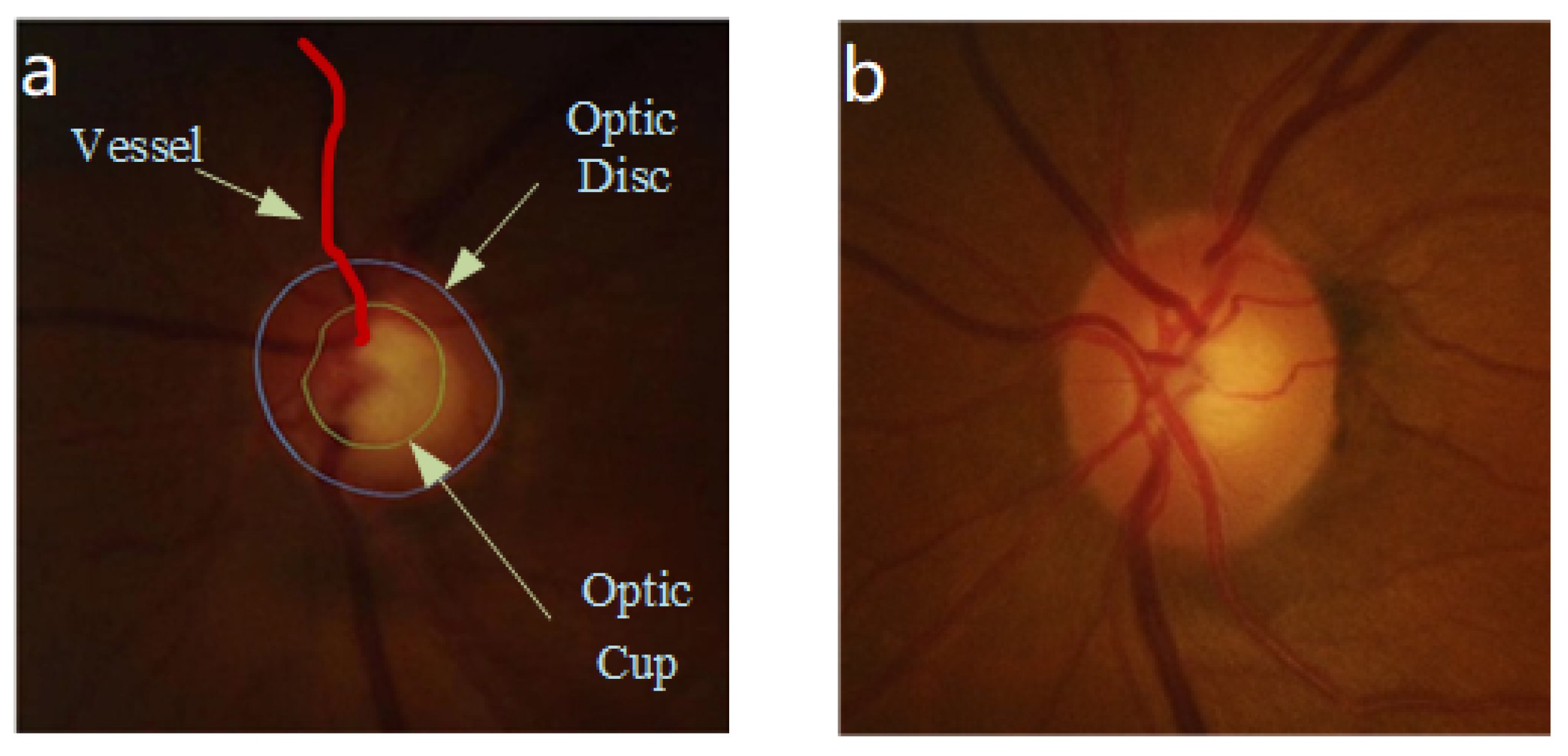 Entropy 24 00796 g001