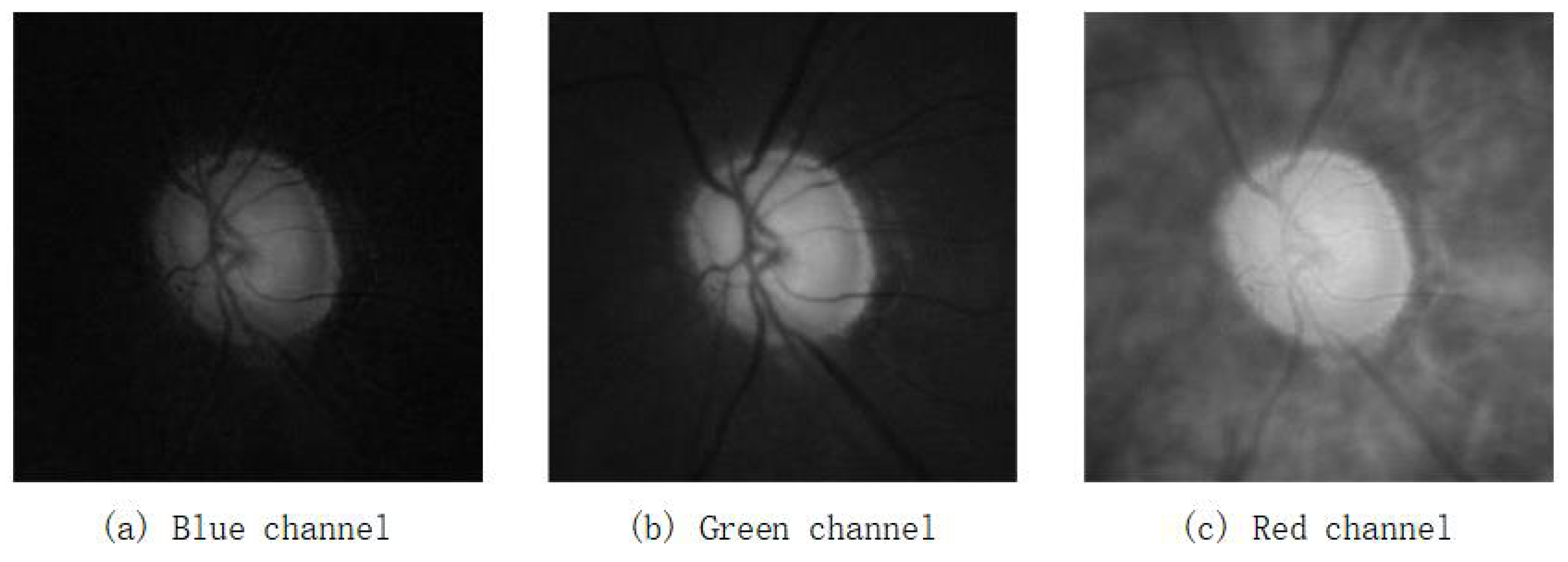 Entropy 24 00796 g003